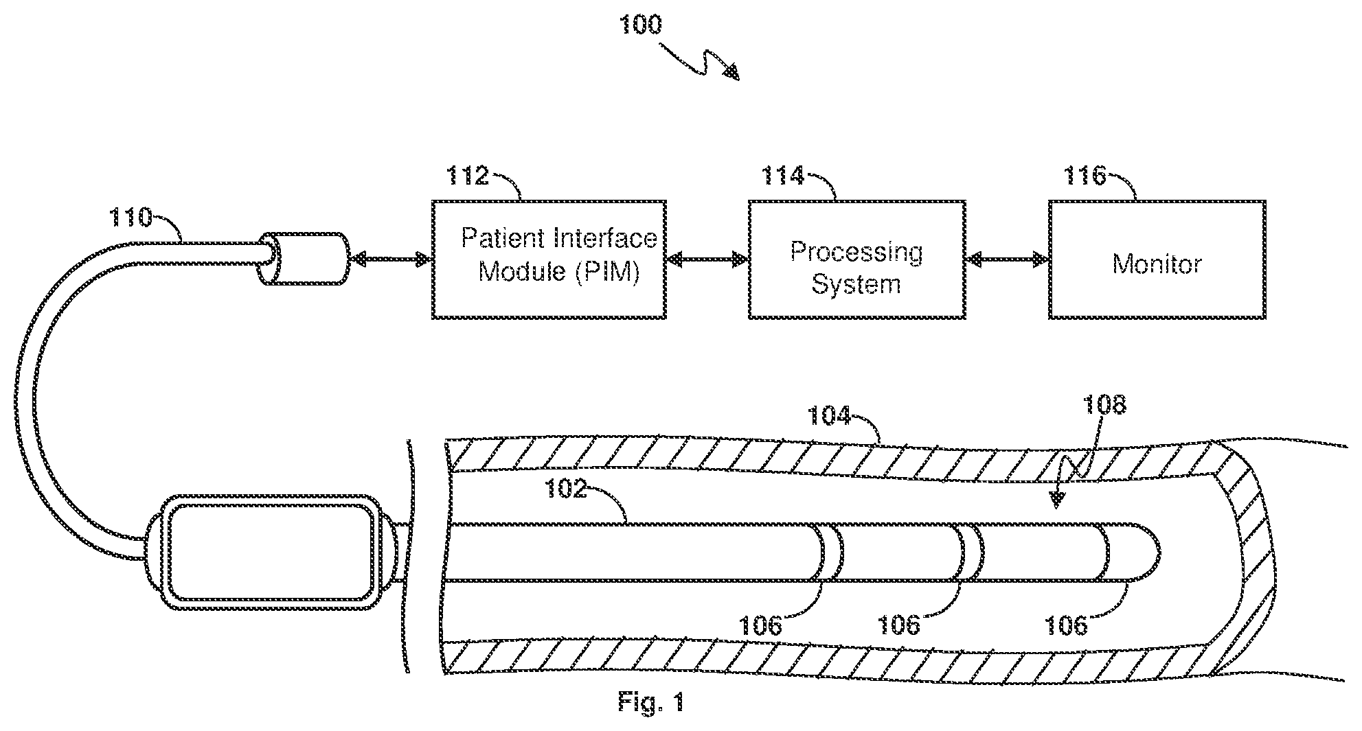 Patent US12167931 — Sensor interface device providing digital processing of intravascular flow and pressure data — Figure 1
