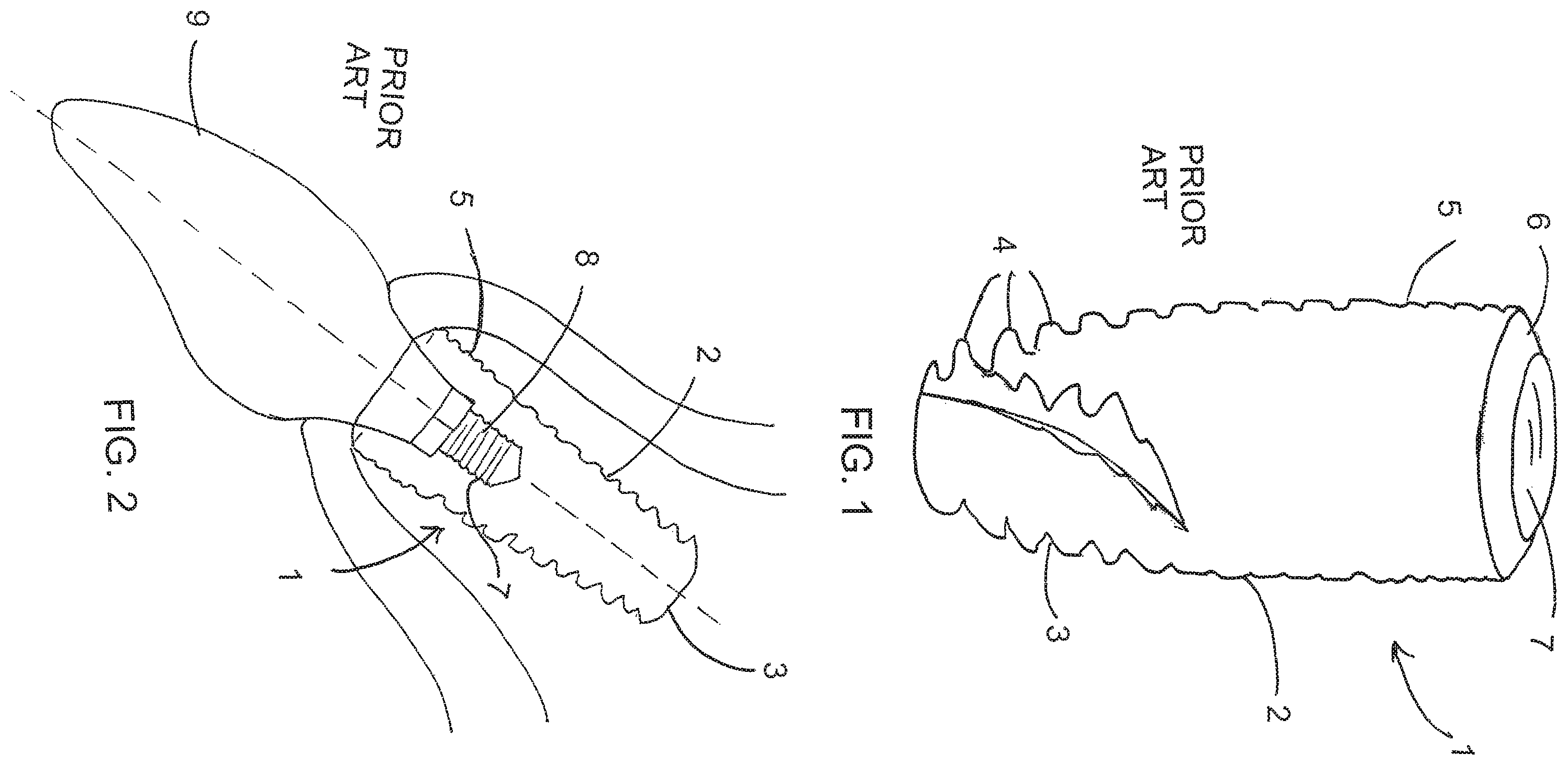 Patent US12167950 — Dental implant — Figure 1