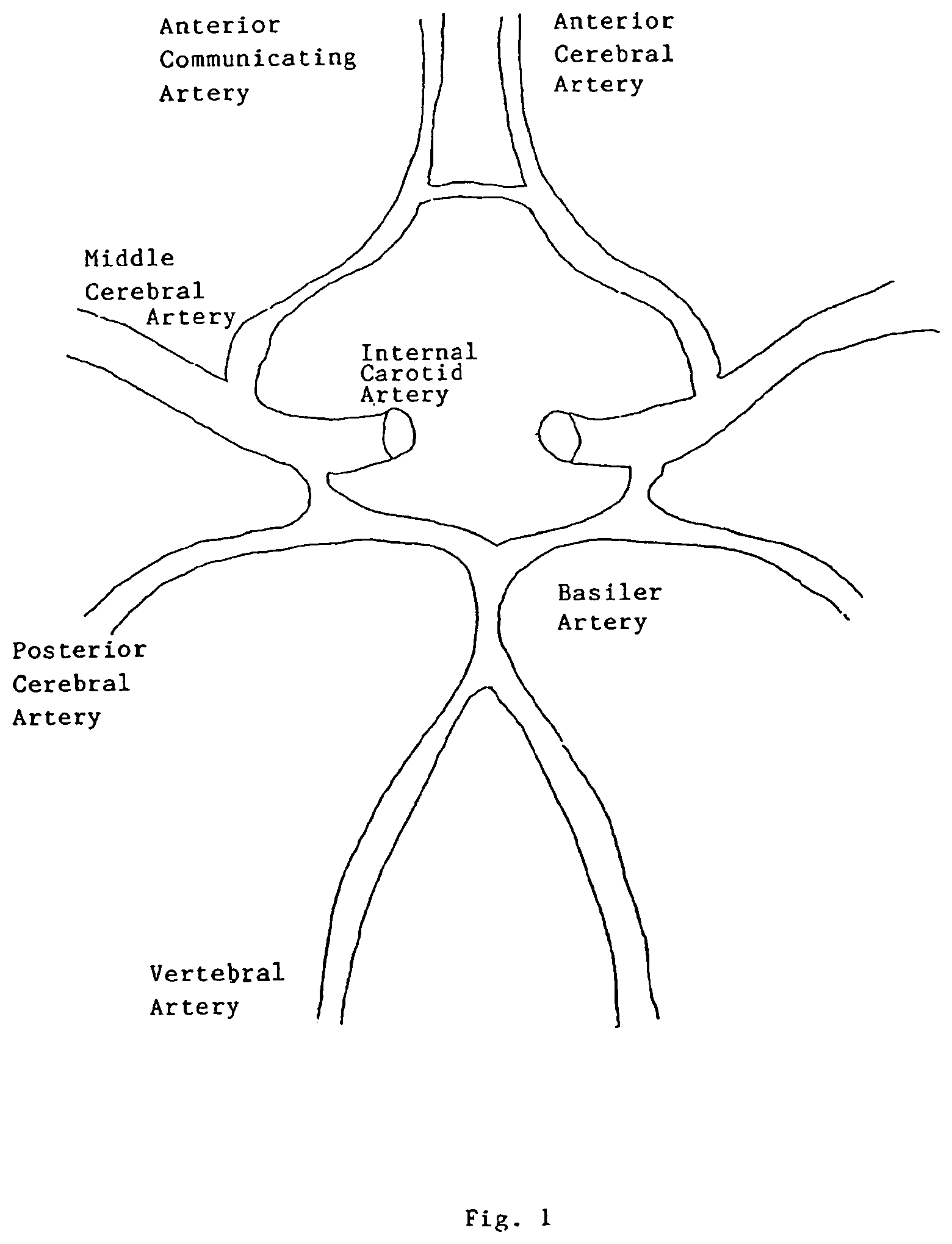 Patent US12167956 — Lasso filter tipped microcatheter for simultaneous rotating separator, irrigator for thrombectomy and method for use — Figure 1