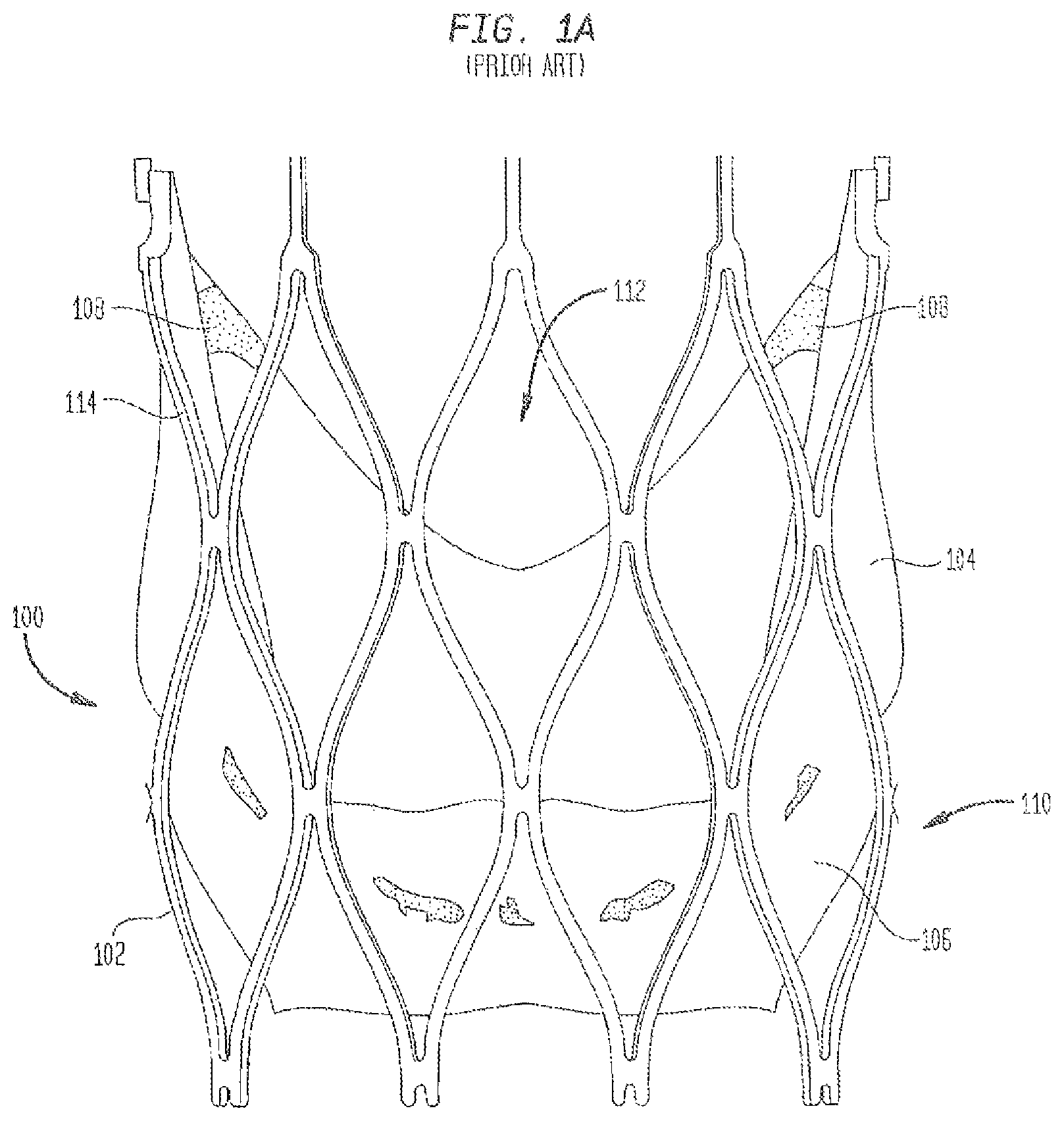 Patent US12167962 — Valve leaflet attachment in collapsible prosthetic valves — Figure 1