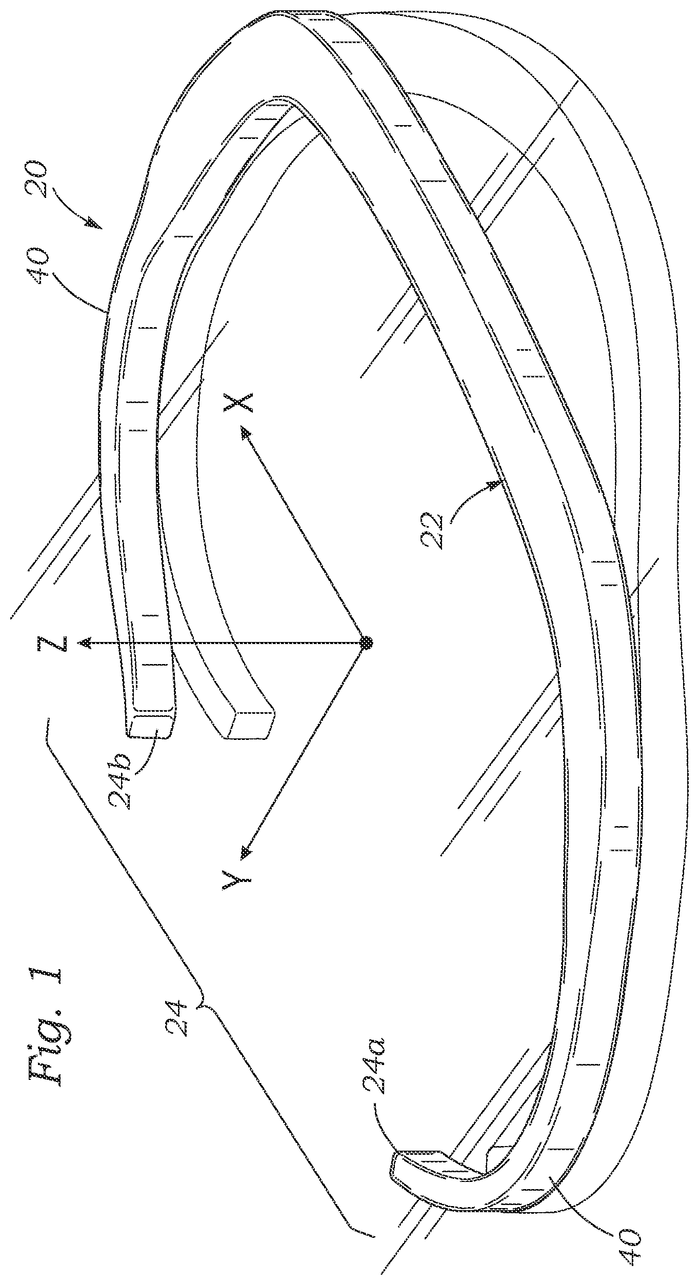 Patent US12167964 — Minimally-invasive low strain annuloplasty ring — Figure 1