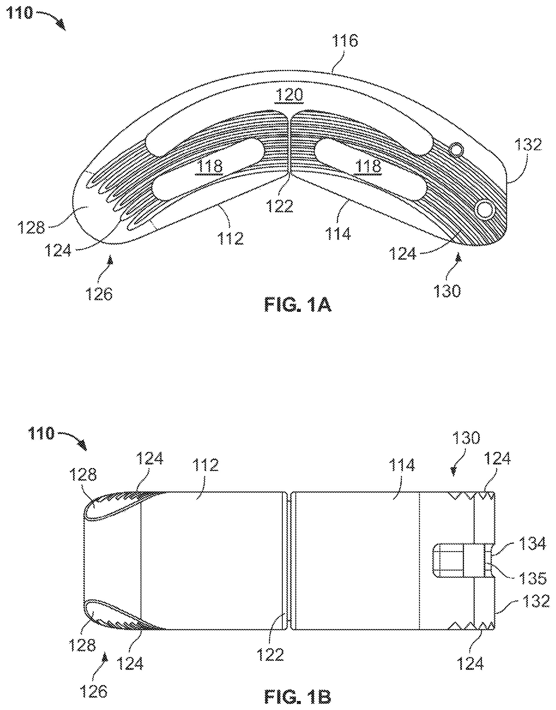 Patent US12167967 — Flexible interbody implant — Figure 1