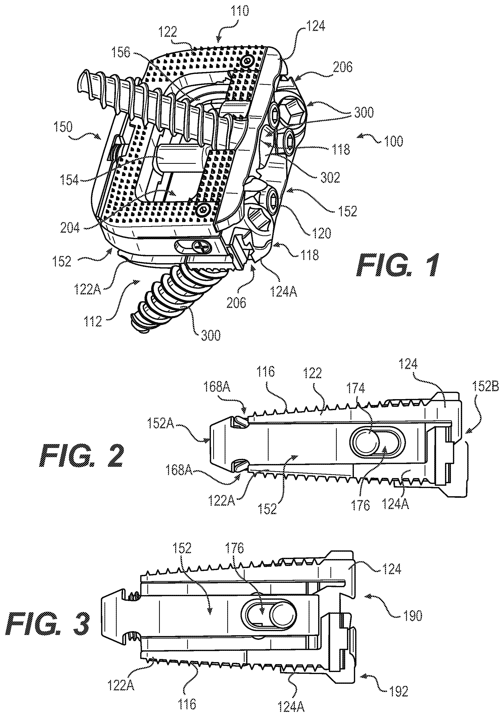 Patent US12167970 — Expandable inter vertebral implant — Figure 1