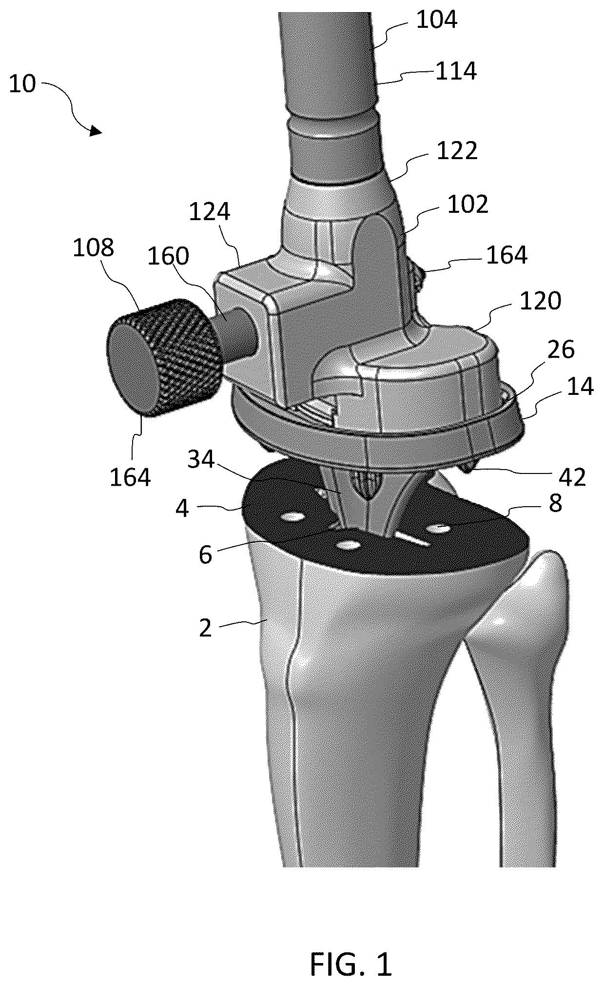 Patent US12167972 — Tibial tray inserter — Figure 1