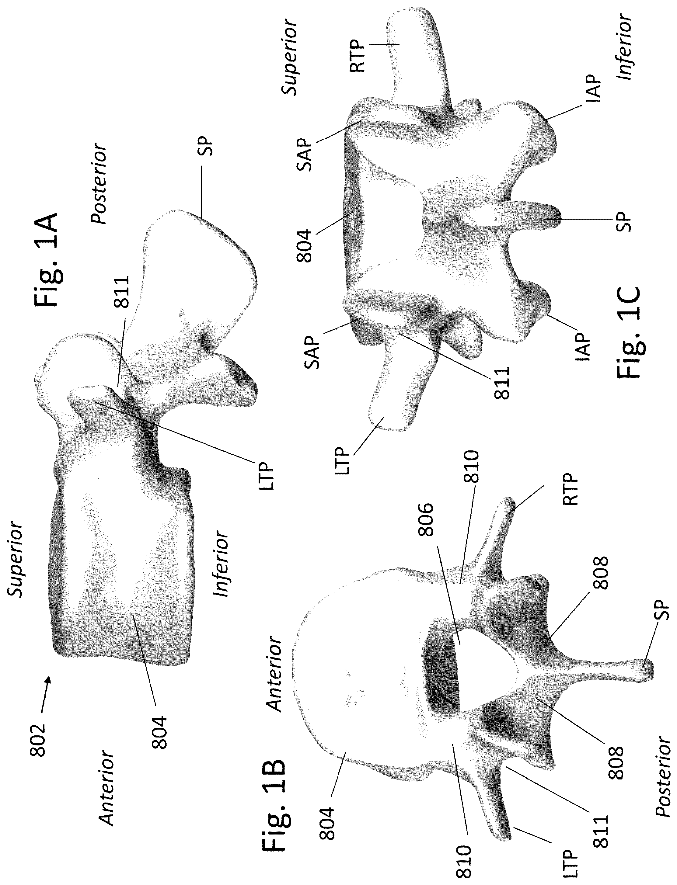 Patent US12167973 — Spinal fixation devices and methods of use — Figure 1