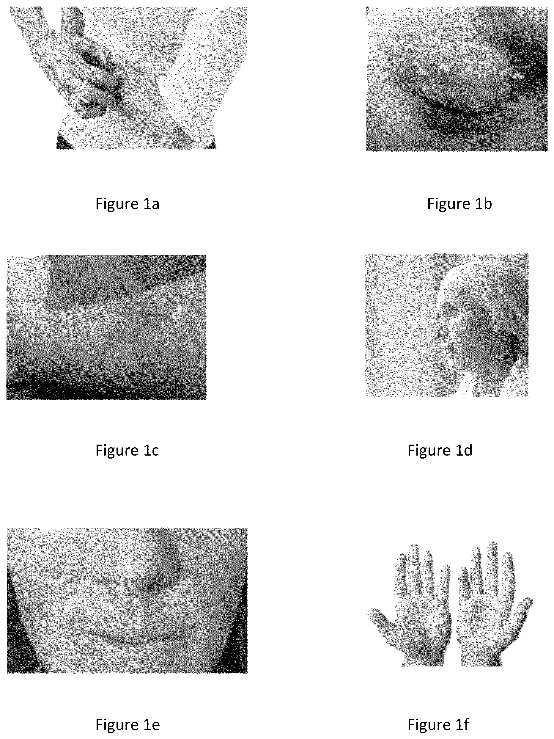 Patent US12174172 — Method for evaluating the efficacy of a composition in reducing the effects of cancer therapeutics on skin — Figure 1