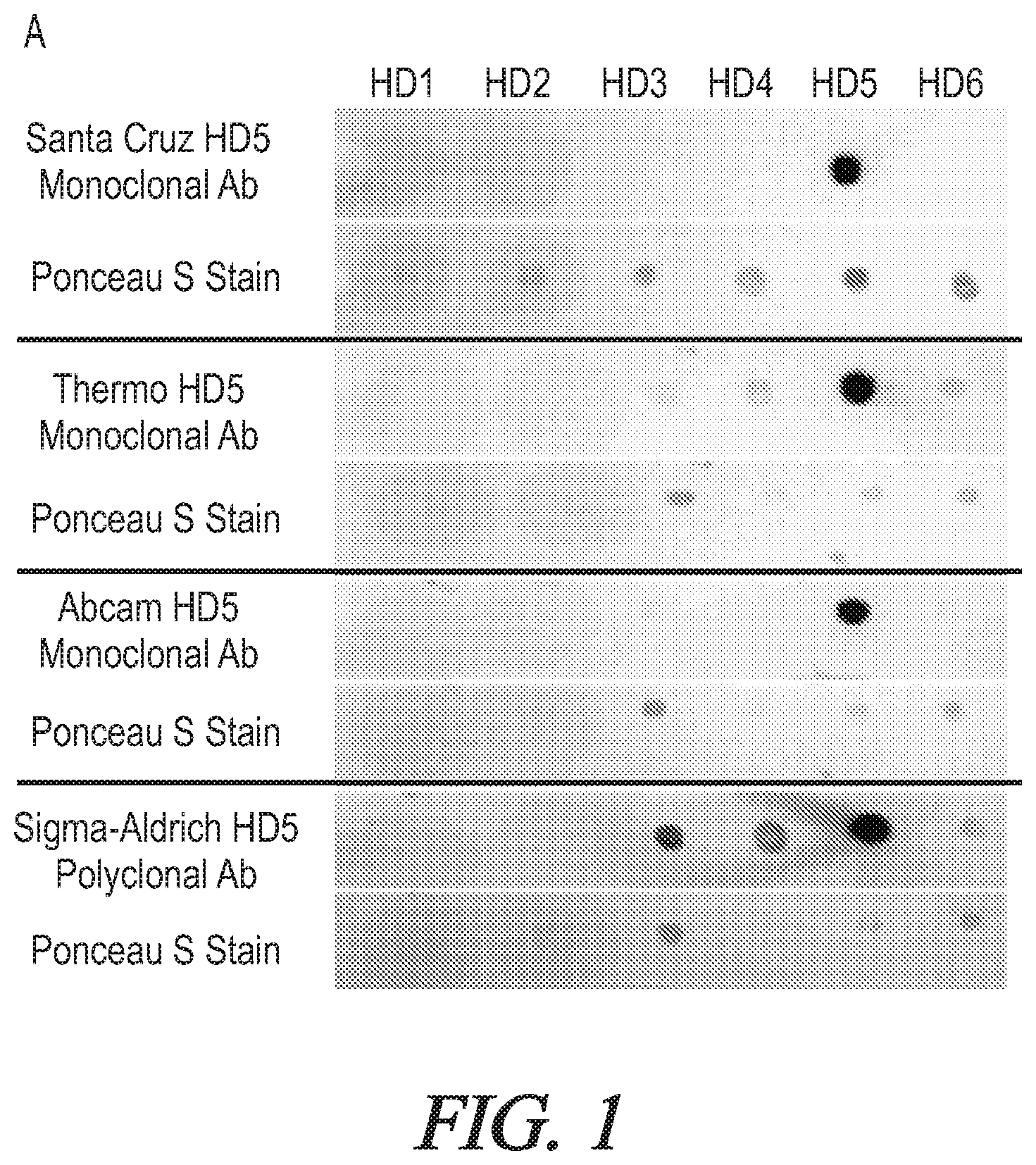 Patent US12174200 Figure 1 – Targeted HD5 antibody and assay methods for diagnosing and treating inflammatory bowel disease