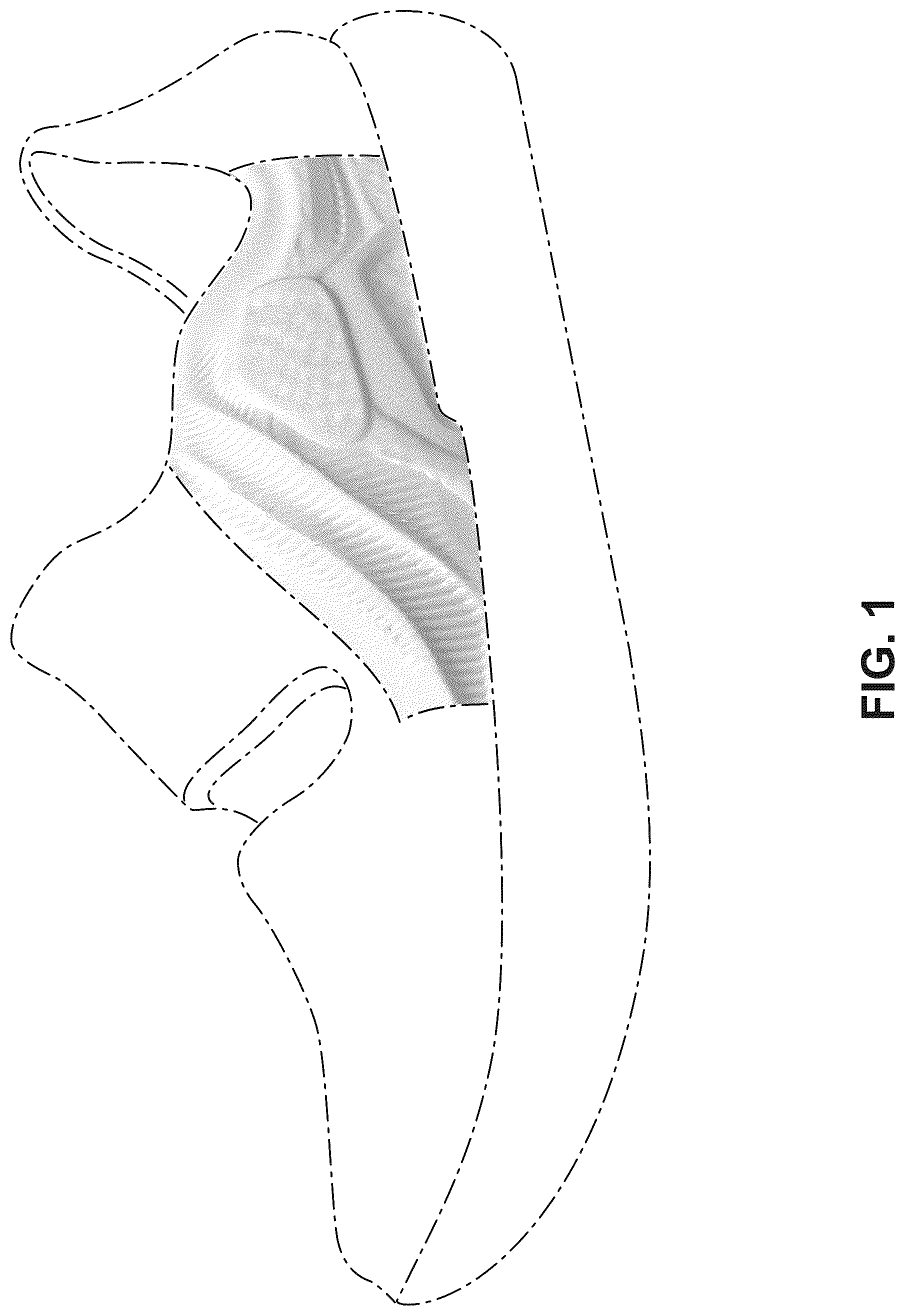 Patent USD1043087 Figure 1 – Shoe