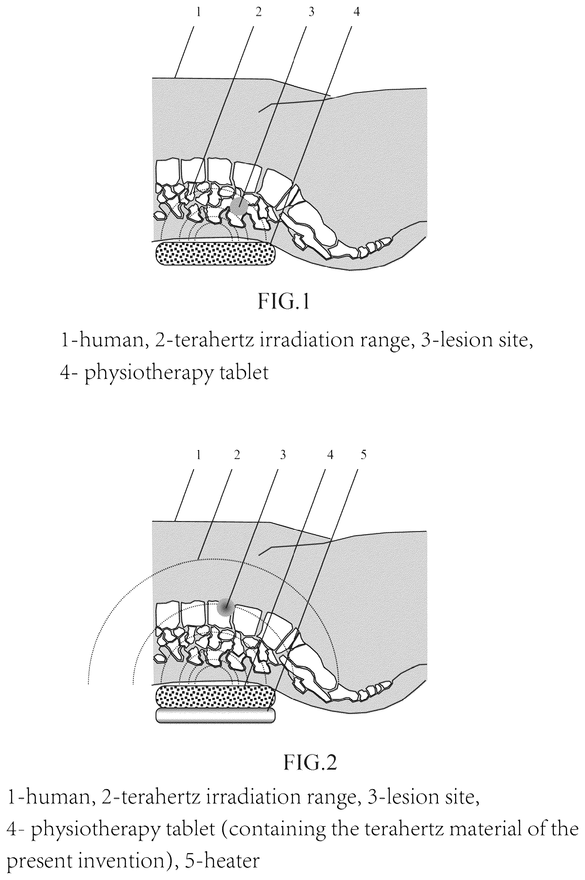 Patent US12297114 — Terahertz material with therapeutic and health care effect and its preparation method and application — Figure 1