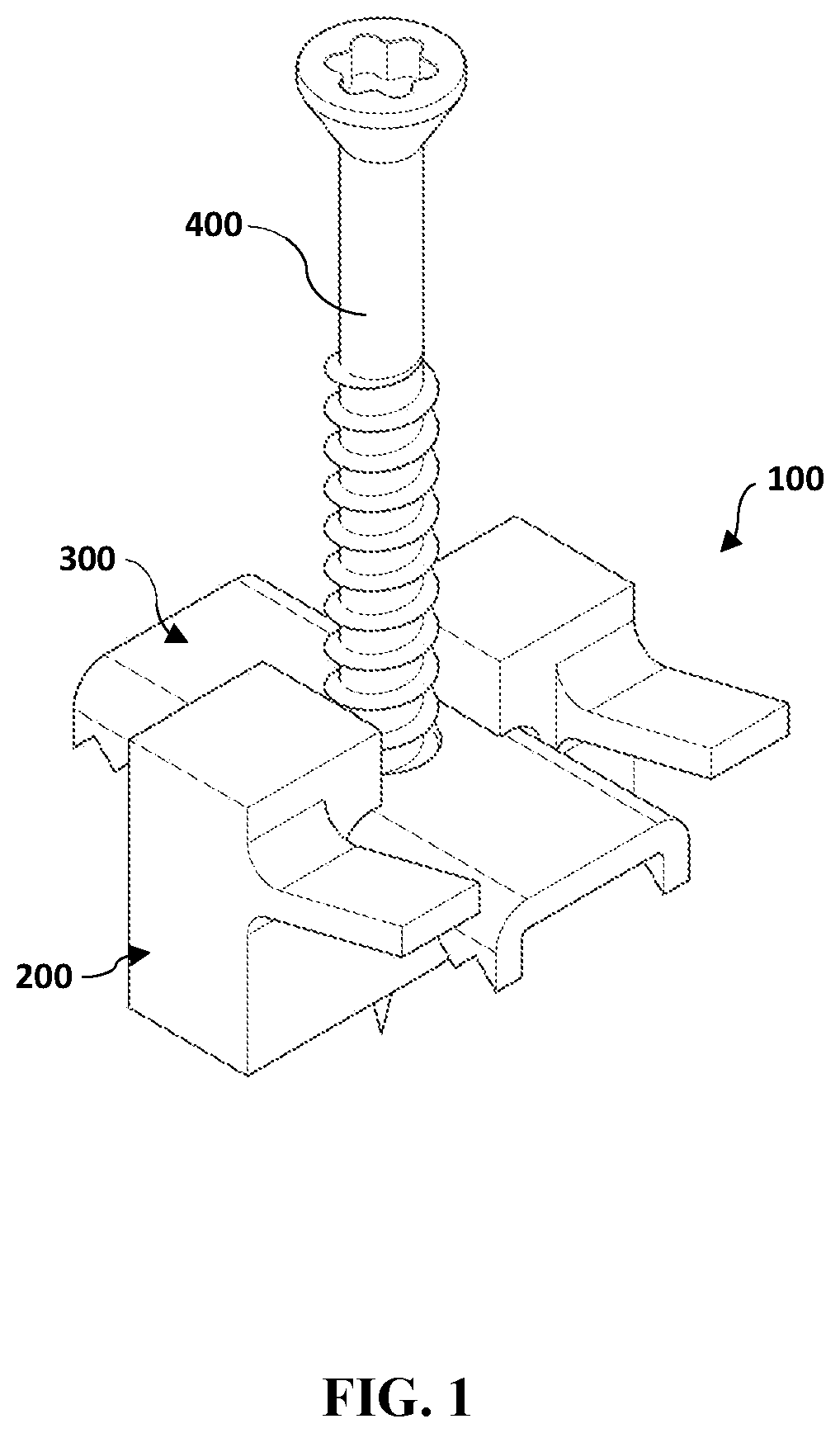 Patent US12297649 — Deck clip — Figure 1