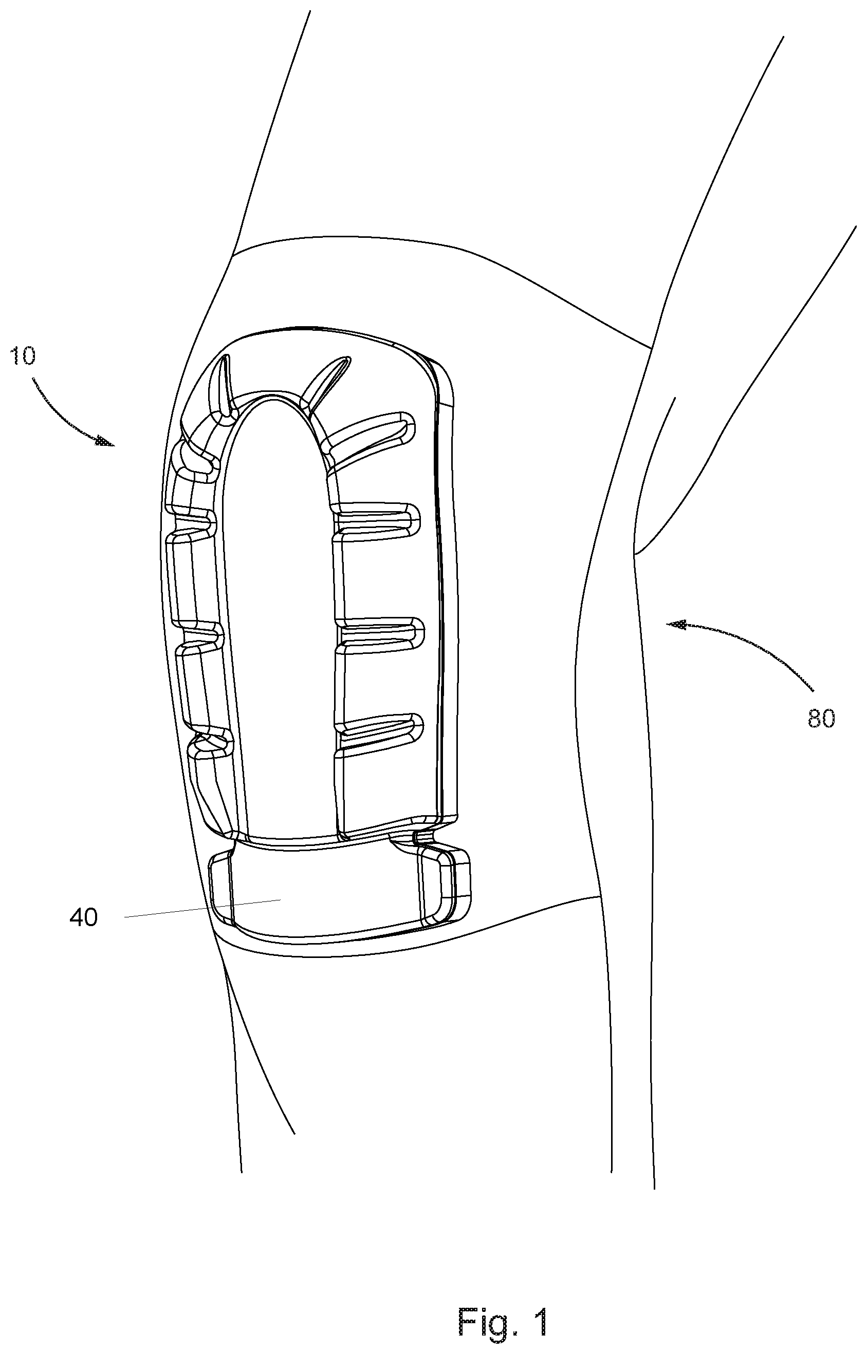 Patent US12302960 Figure 1 – Body part pad