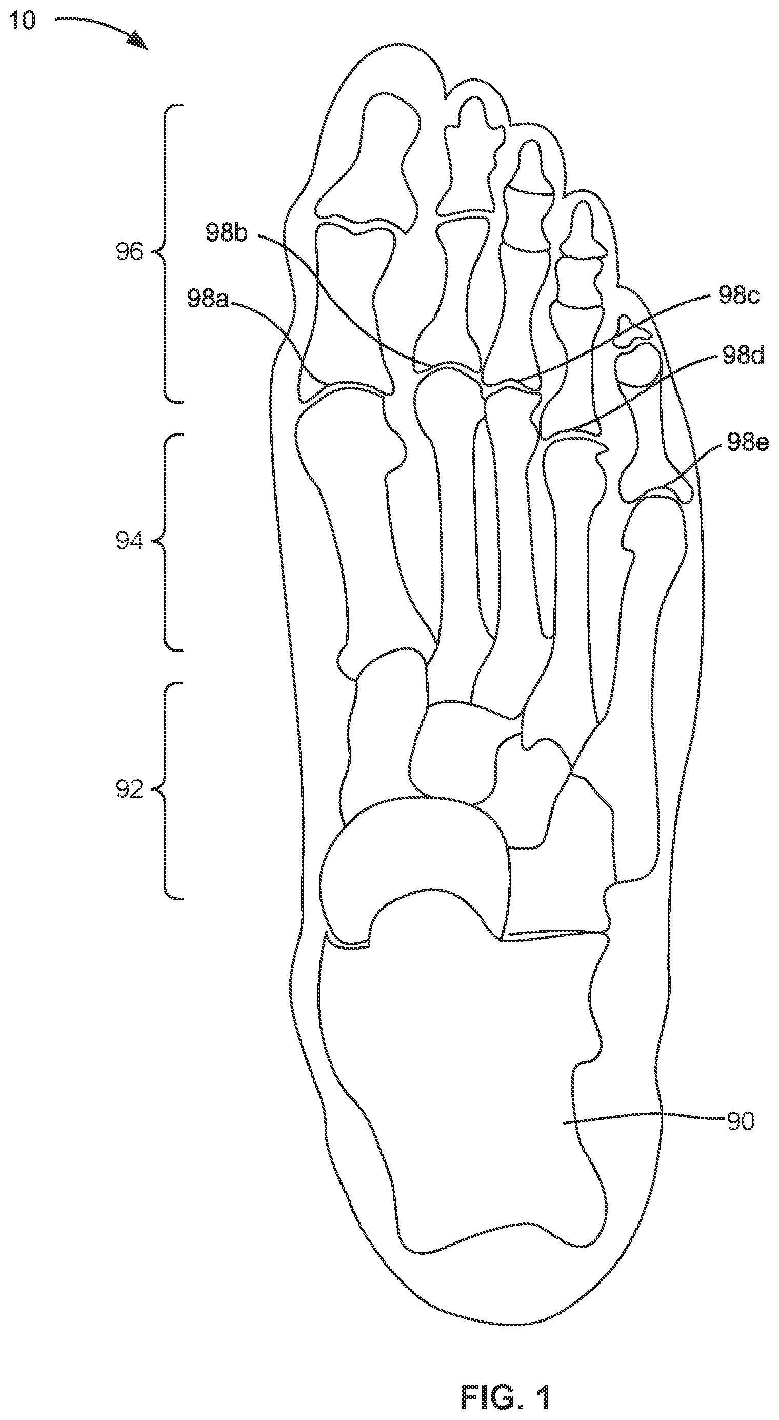 Patent US12302994 Figure 1 – Outsole pattern for an article of footwear