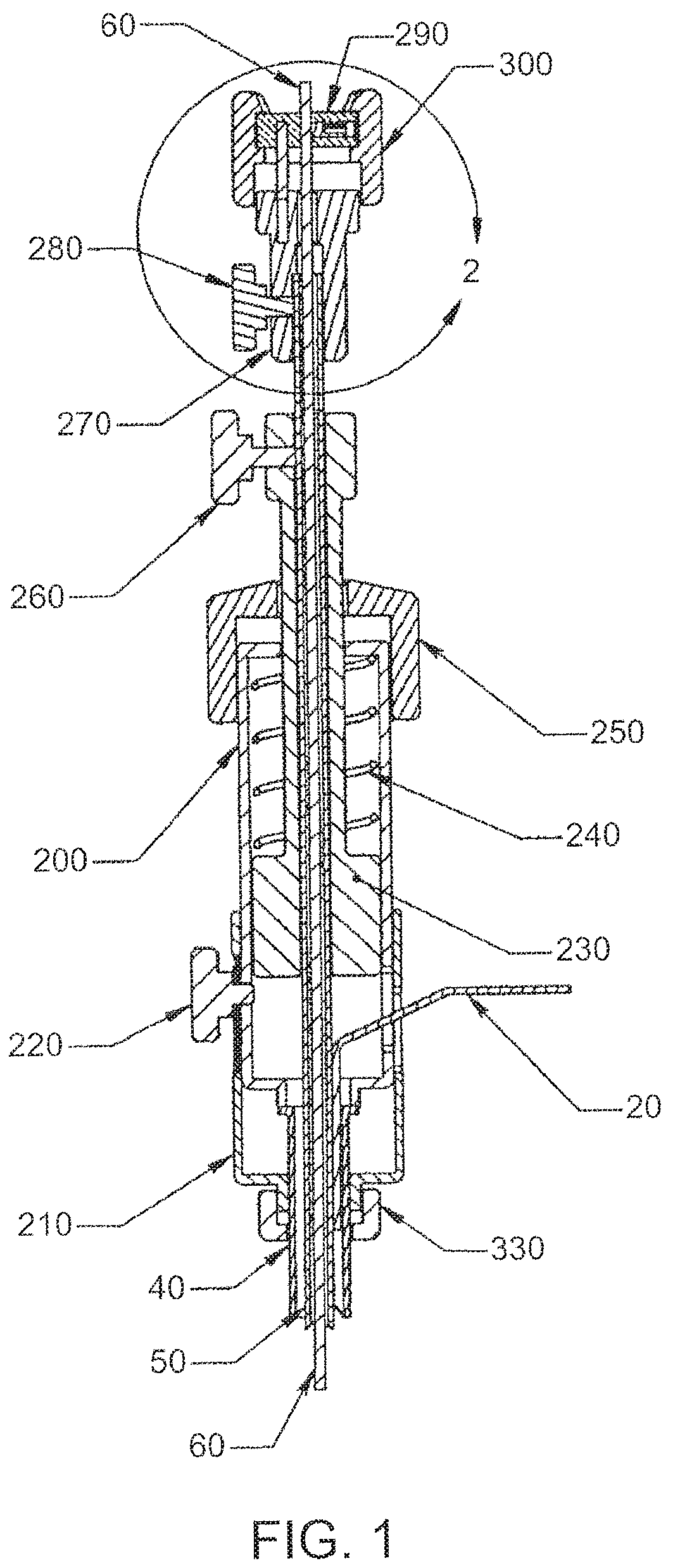 Patent US12303105 — Luminal structure anchoring devices and methods — Figure 1