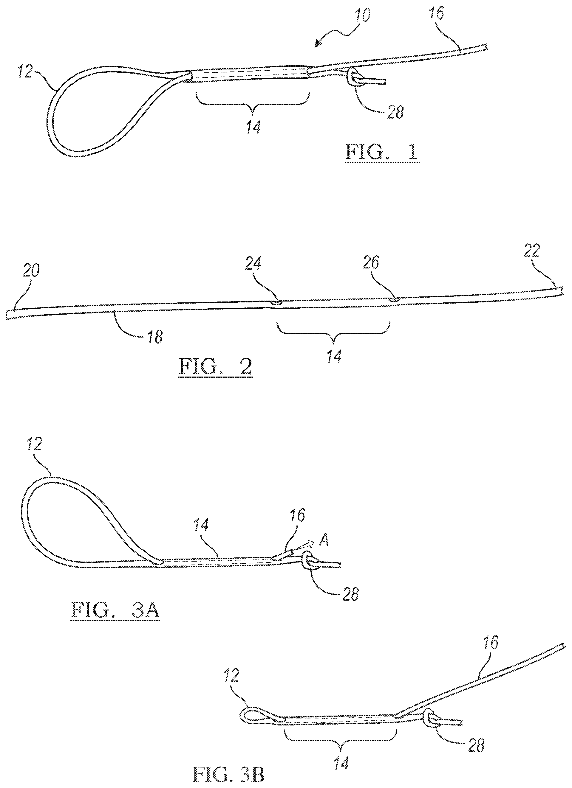 Patent US12303122 — Adjustable knotless loops — Figure 1