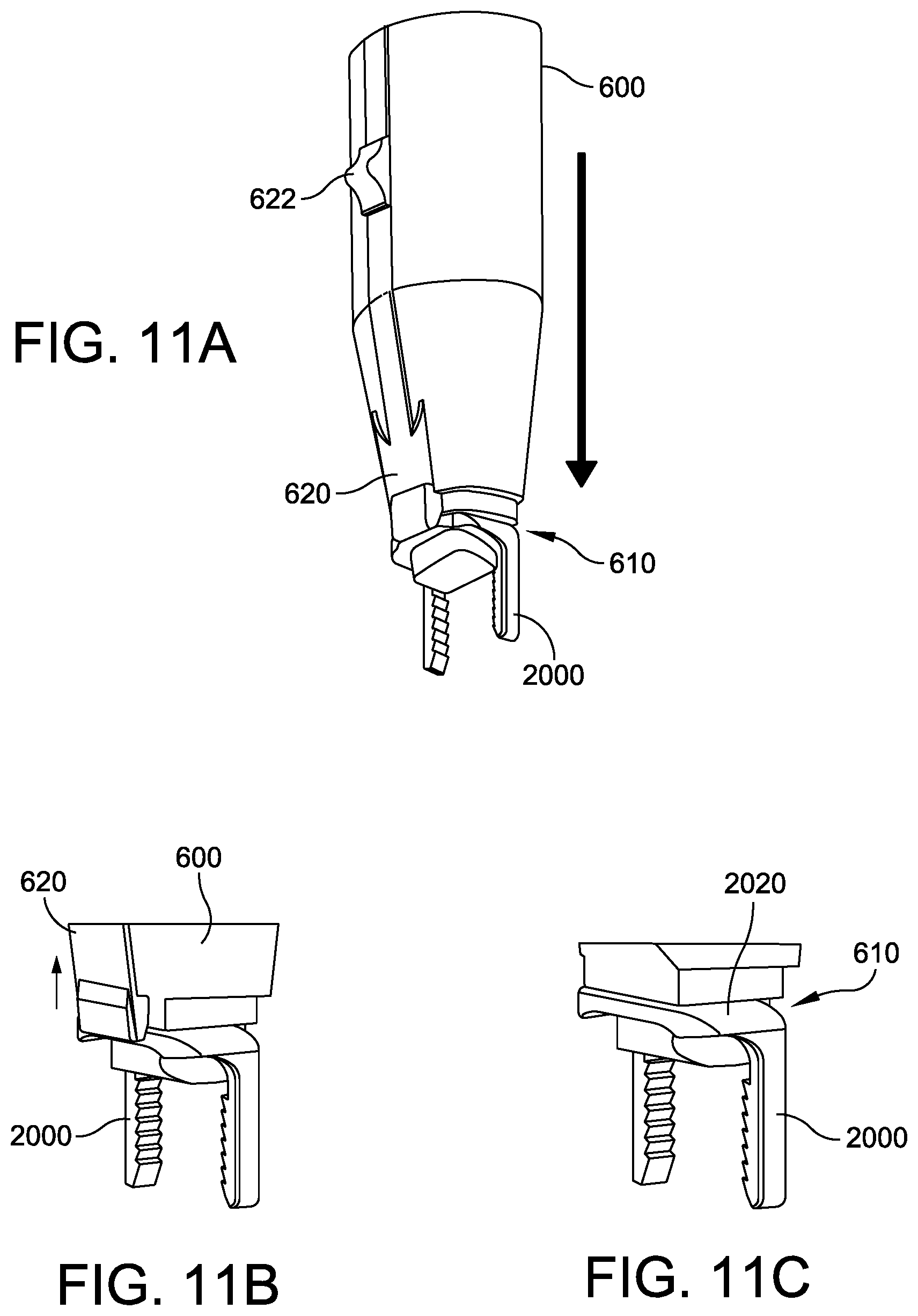 Patent US12303147 Figure 17 – Orthopedic staple and related instruments