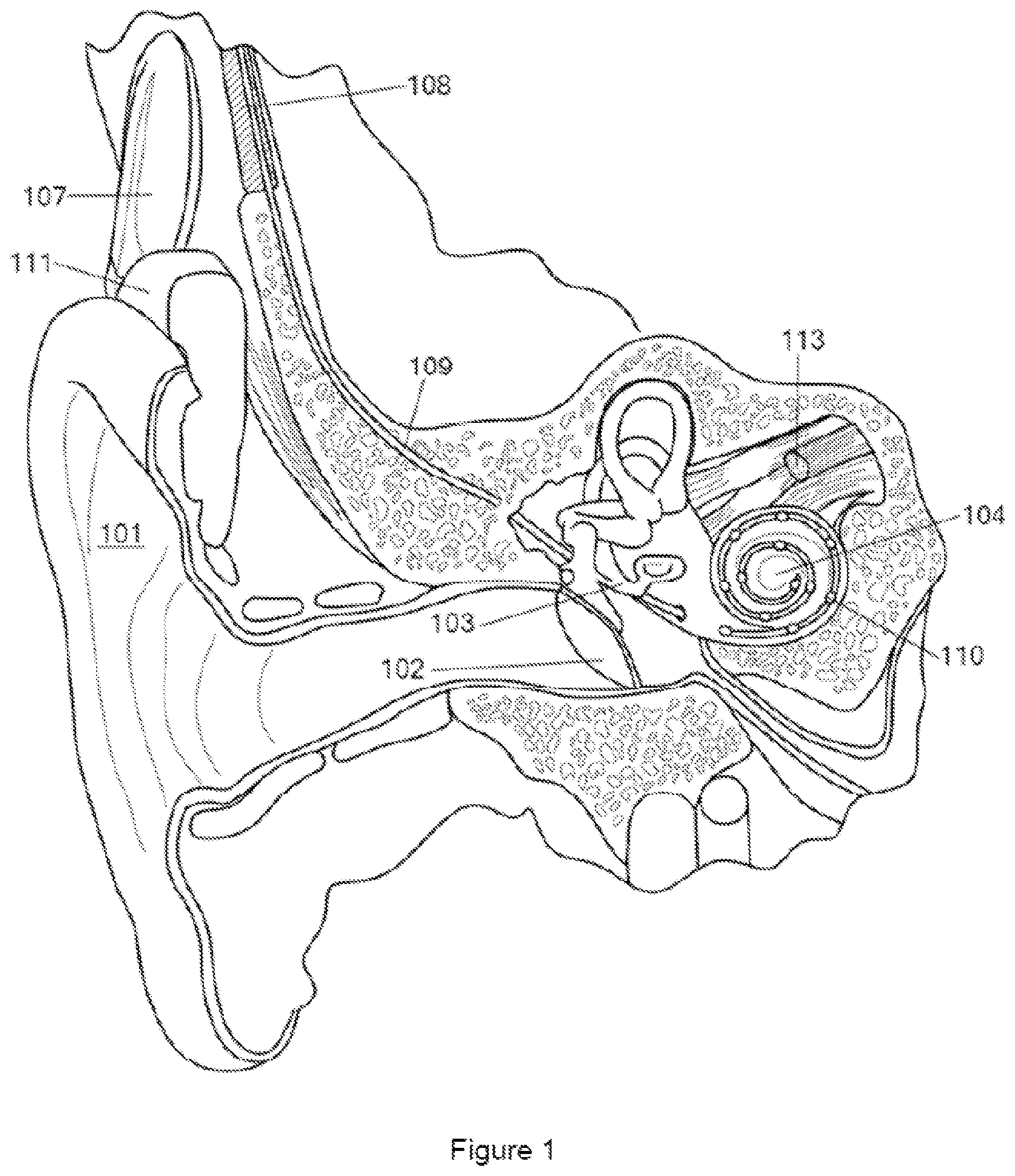 Patent US12303148 Figure 1 – Drilling platform tool for surgeries