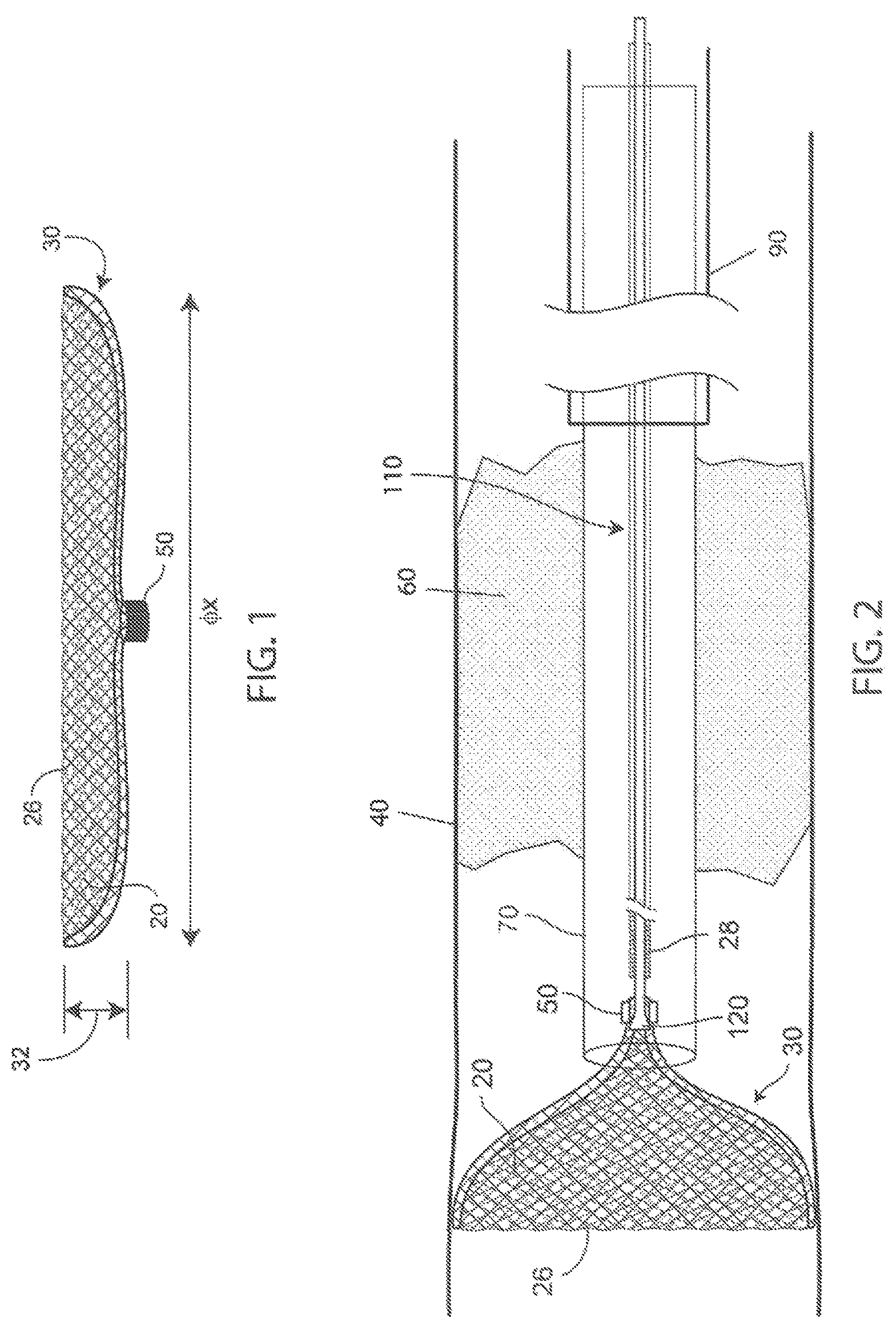 Patent US12303153 Figure 1 – Clot removal distal protection methods