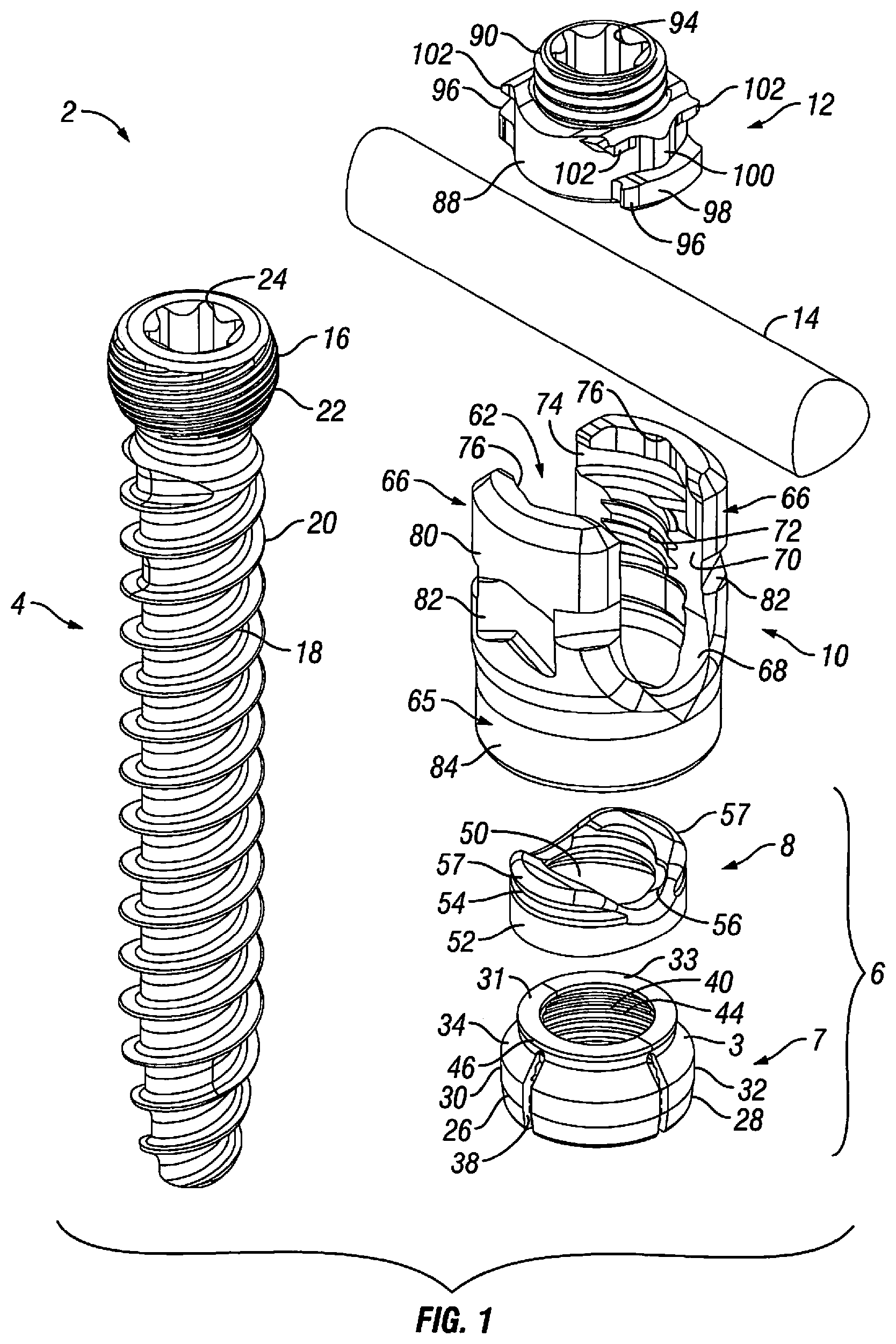 Patent US12303170 — Orthopedic fixation devices and methods of installation thereof — Figure 1