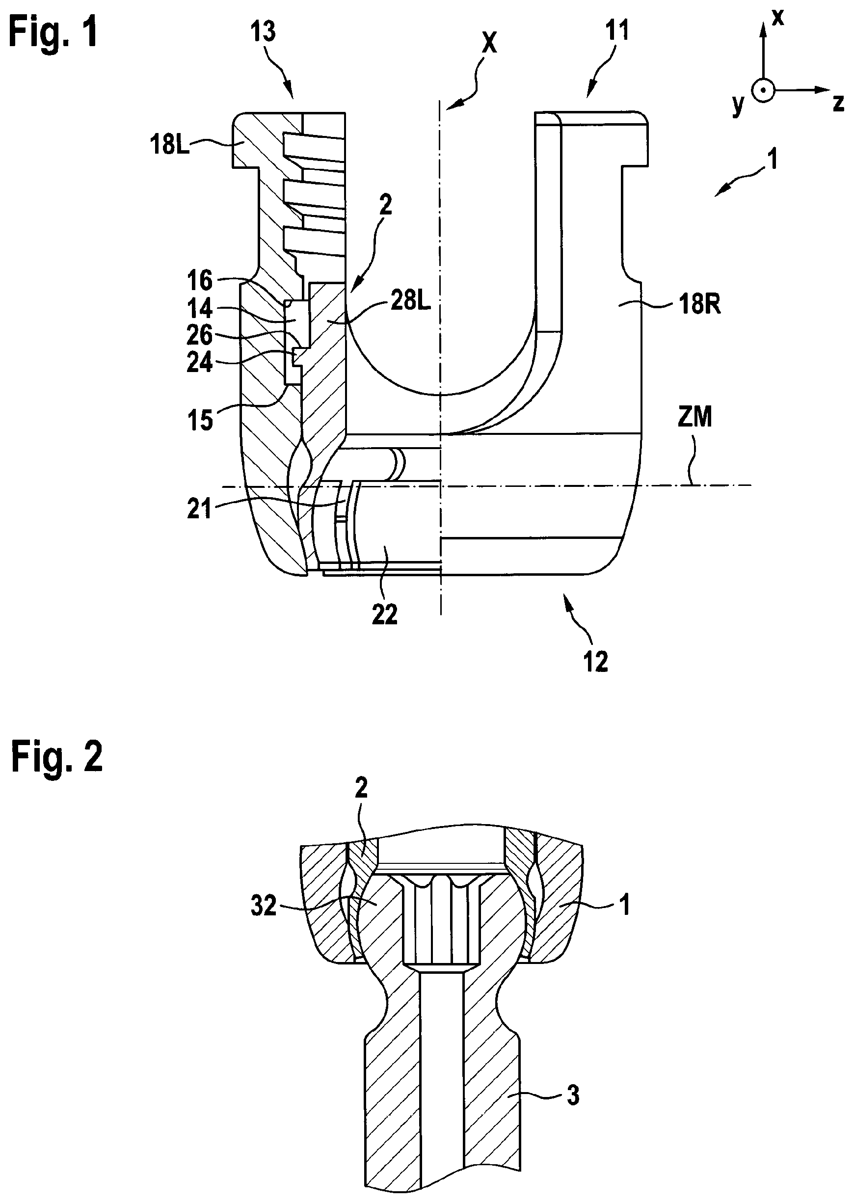 Patent US12303173 — Implant, in particular a spinal implant — Figure 1