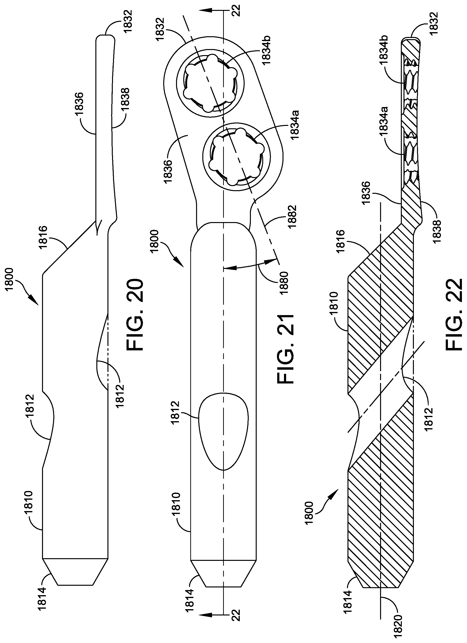Patent US12303174 Figure 13 – Implant with intramedullary portion and variable angle extramedullary portion