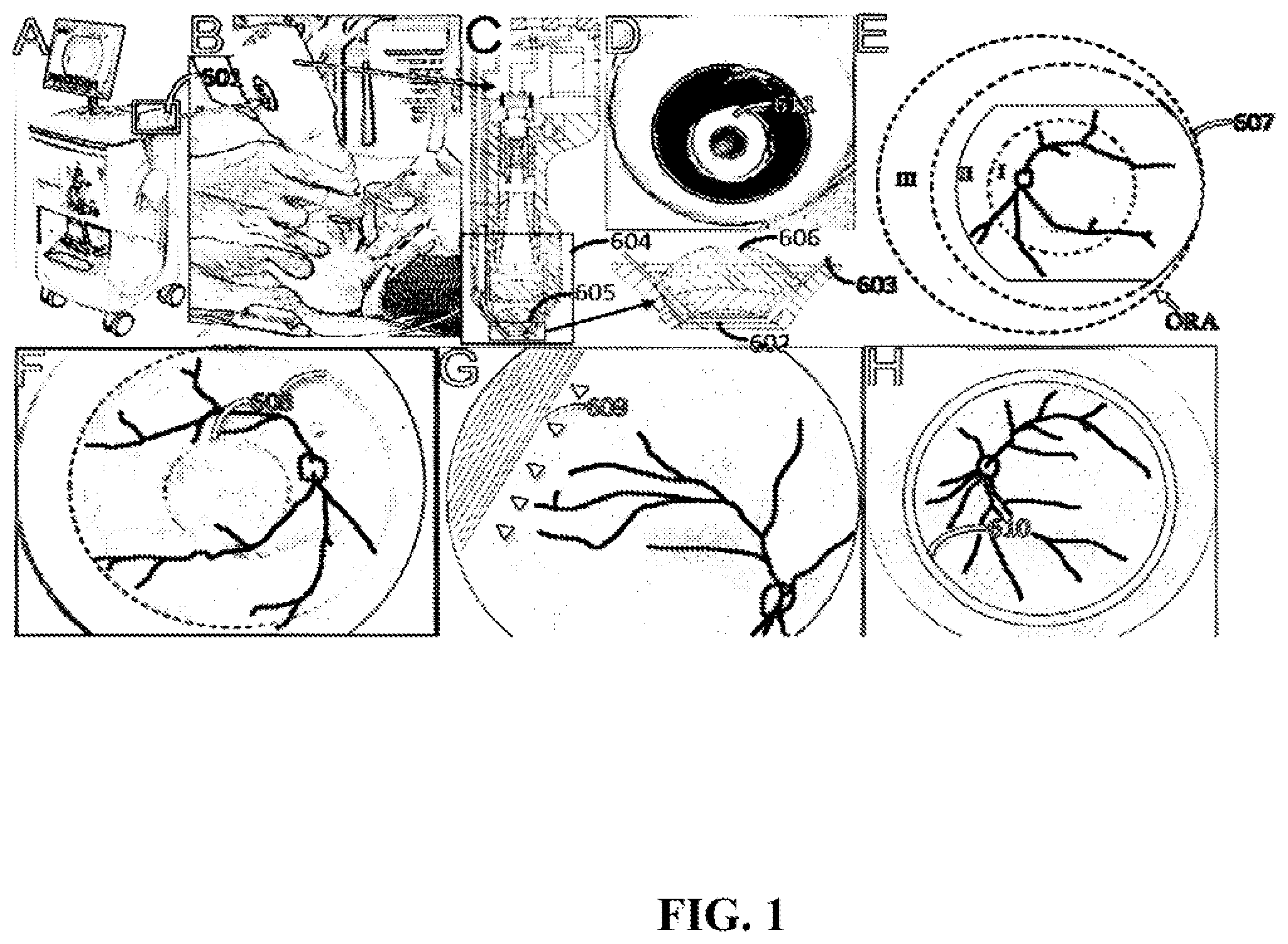 Patent US12303199 — Wide field fundus camera — Figure 1