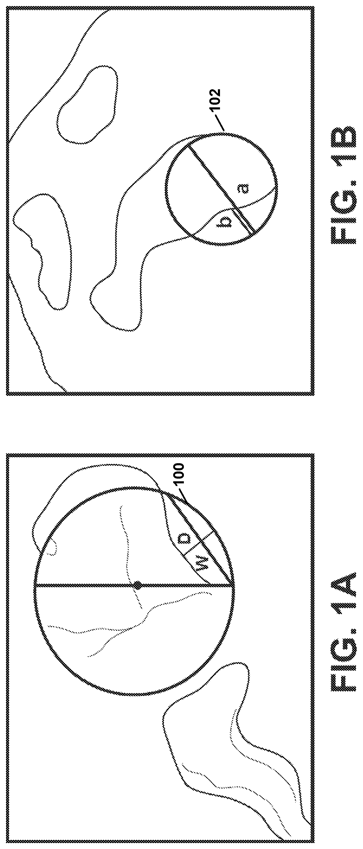 Patent US12303207 — Automated planning of shoulder stability enhancement surgeries — Figure 1