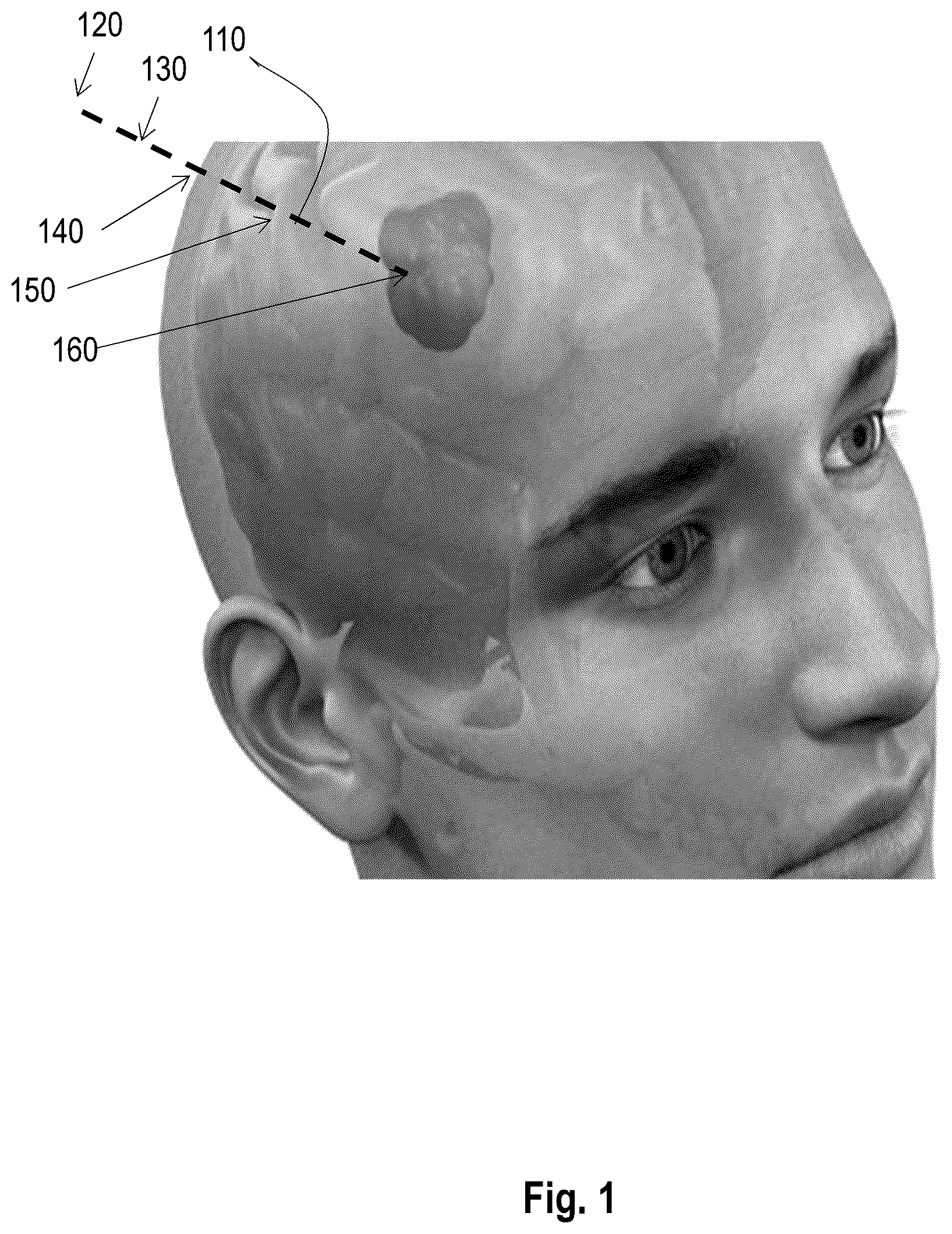 Patent US12303208 — Method and system to augment medical scan image information on extended reality image — Figure 1
