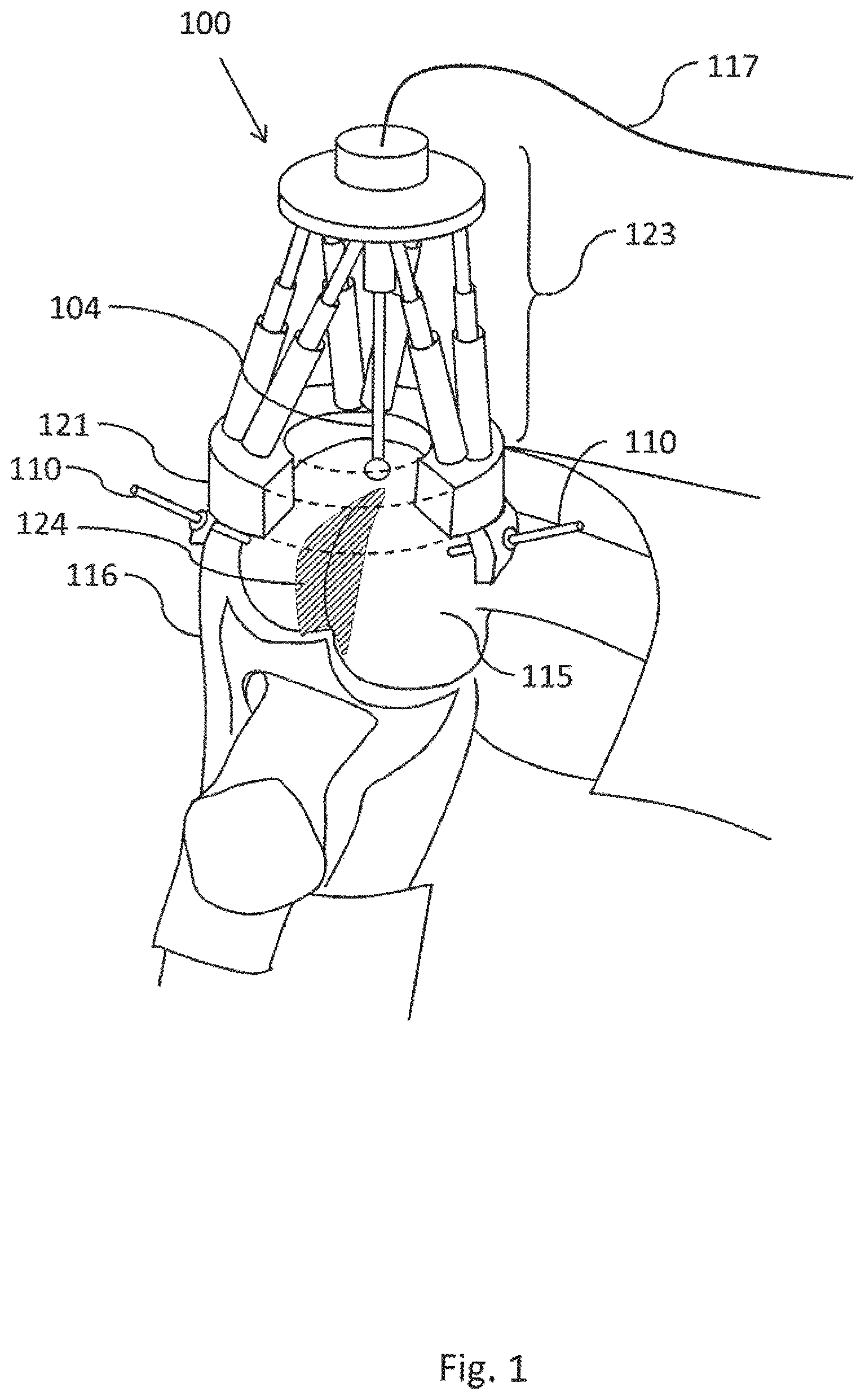 Patent US12303219 — Miniature bone-mounted robot for IN-SITU three-dimensional bioprinting — Figure 1