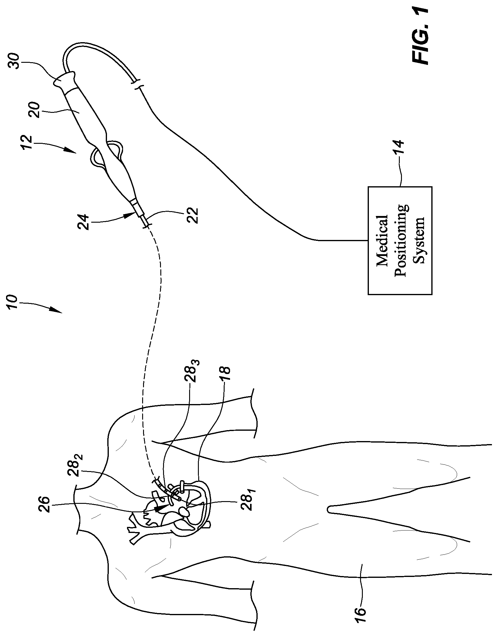 Patent US12303249 — Localized magnetic field generator — Figure 1