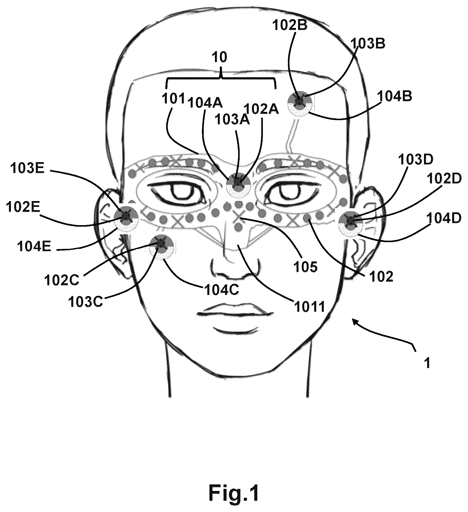 Patent US12303272 — Multi-modal 3D marker for co-registration of biomagnetic and magnetic resonance imaging — Figure 1