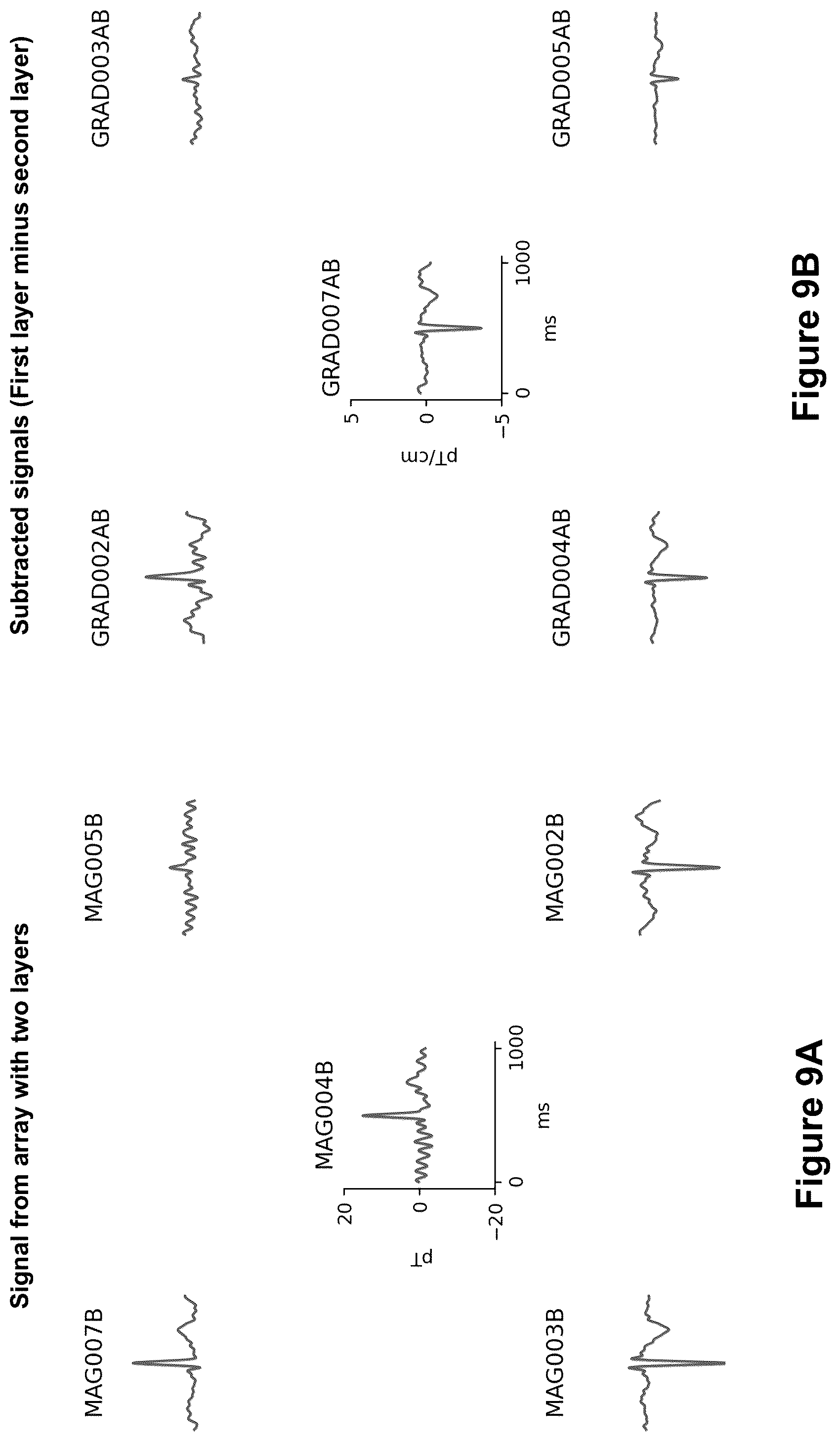 Patent US12303273 Figure 20 – Signal processing methods and systems for biomagnetic field imaging