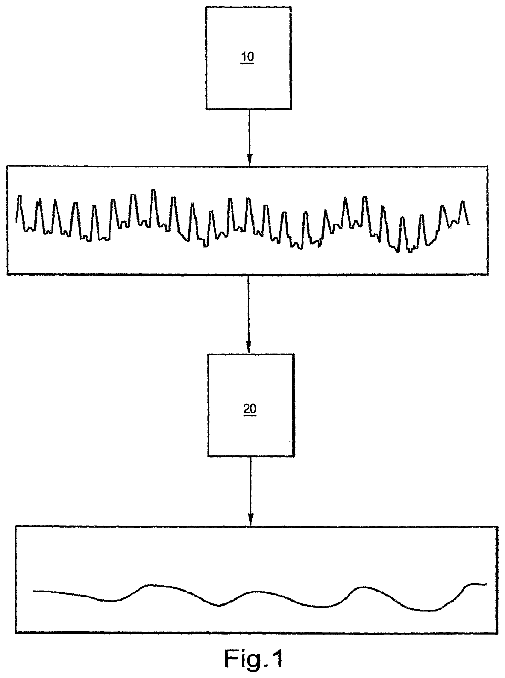 Patent US12303288 — Systems, methods, and/or apparatuses for non-invasive monitoring of respiratory parameters in sleep disordered breathing — Figure 1