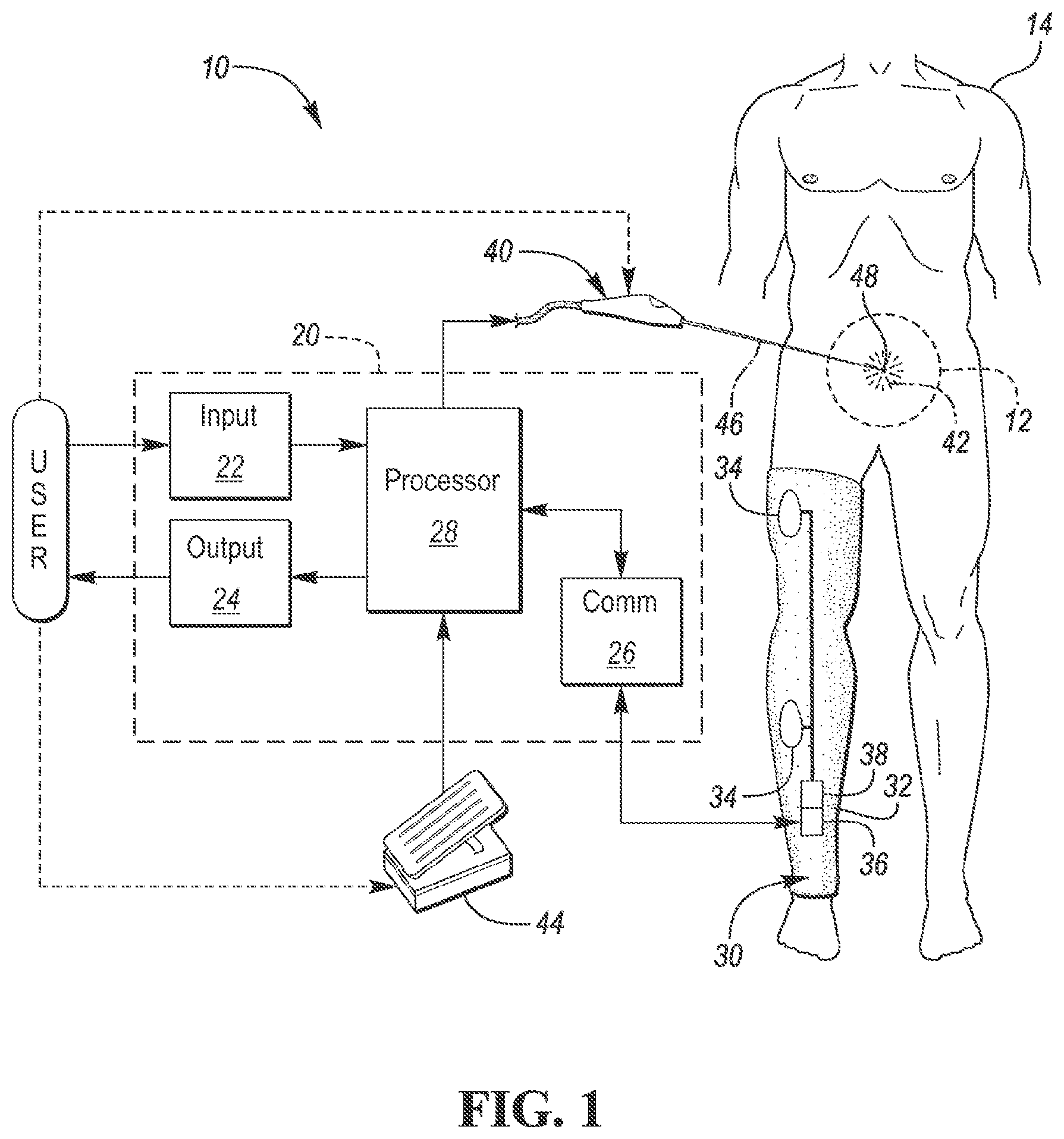 Patent US12303301 — Intraoperative neural monitoring system and method — Figure 1