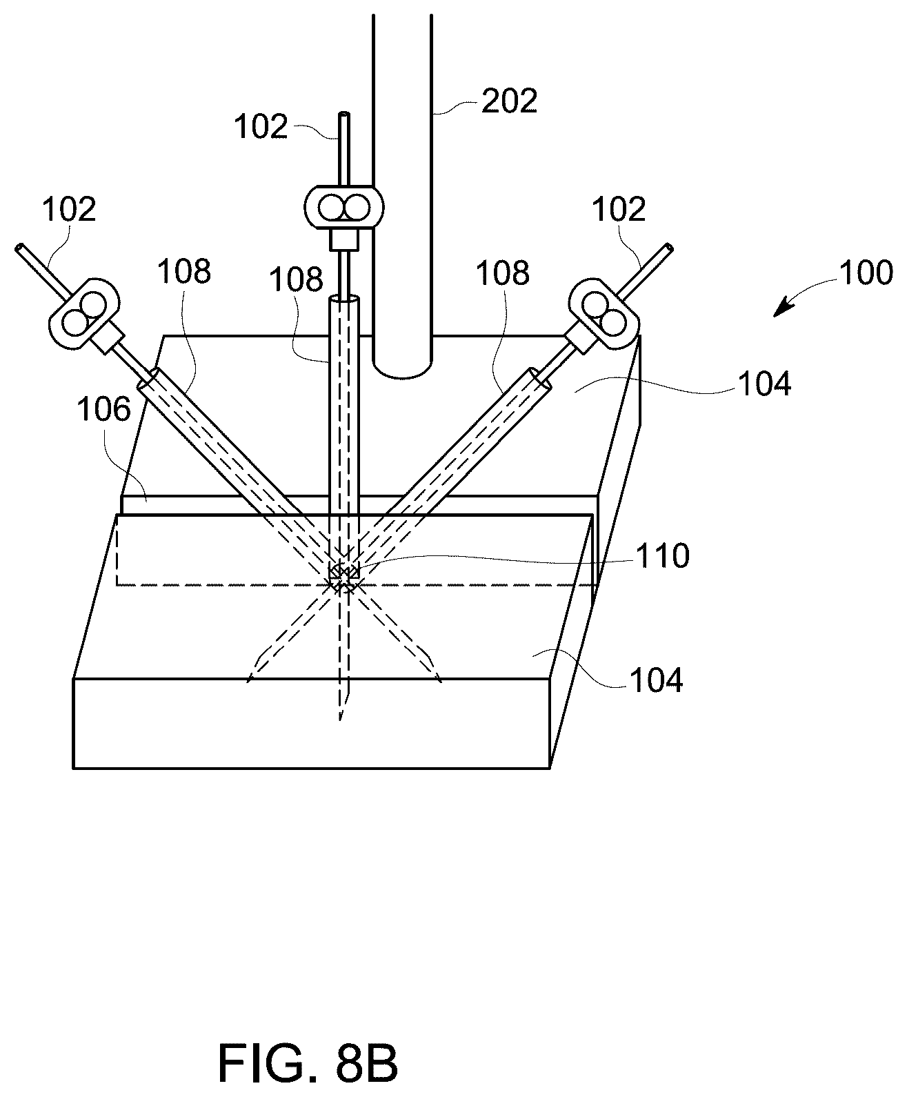 Patent US12303321 Figure 11 – Ultrasound probe with an integrated needle assembly and a computer program product, a method and a system for providing a path for inserting a needle of the ultrasound probe