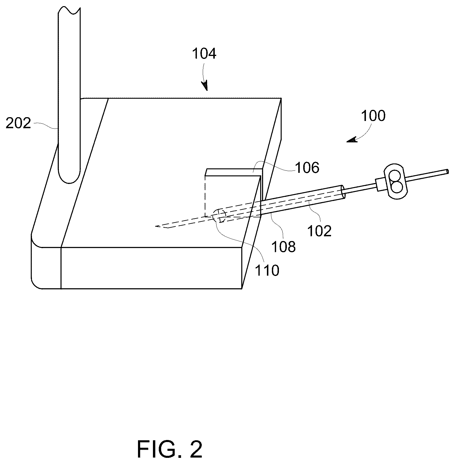 Patent US12303322 Figure 2 – Ultrasound probe with an integrated needle assembly and a computer program product, a method and a system for providing a path for inserting a needle of the ultrasound probe