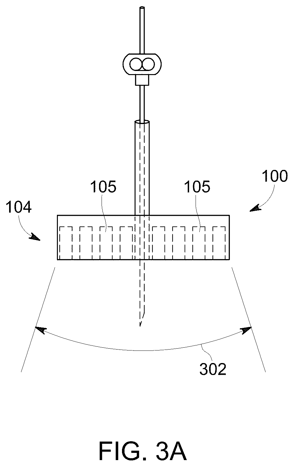 Patent US12303322 Figure 3 – Ultrasound probe with an integrated needle assembly and a computer program product, a method and a system for providing a path for inserting a needle of the ultrasound probe