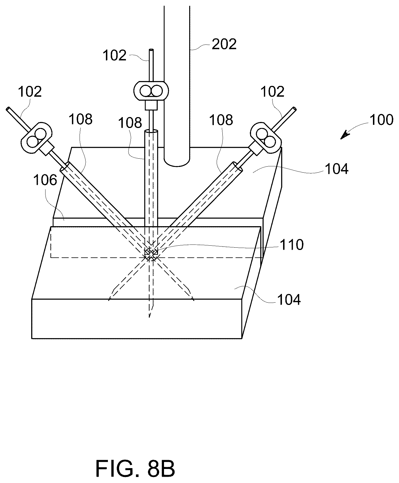 Patent US12303323 Figure 11 – Ultrasound probe with an integrated needle assembly and a computer program product, a method and a system for providing a path for inserting a needle of the ultrasound probe