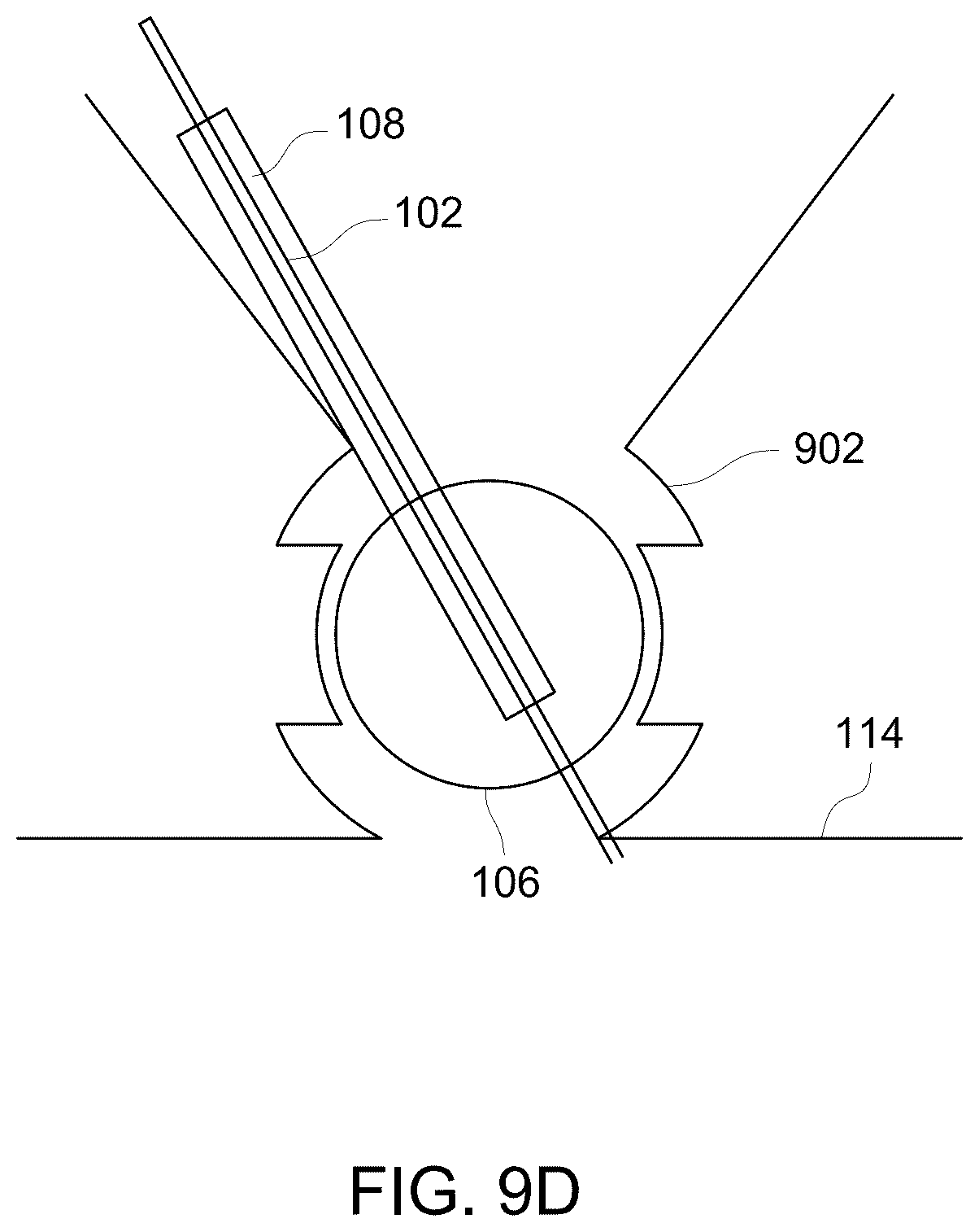 Patent US12303323 Figure 14 – Ultrasound probe with an integrated needle assembly and a computer program product, a method and a system for providing a path for inserting a needle of the ultrasound probe