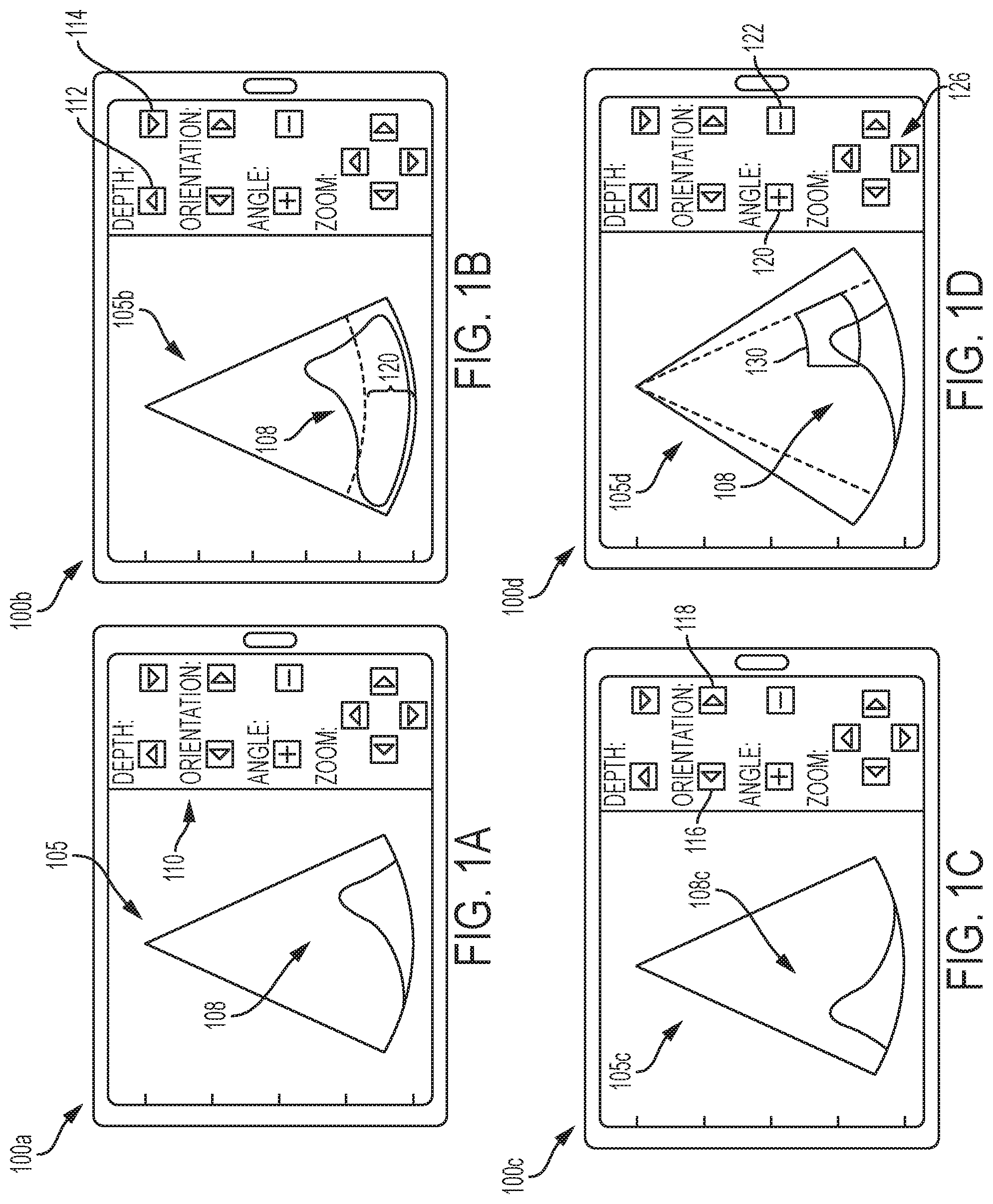 Patent US12303335 — Systems and methods for controlling visualization of ultrasound image data — Figure 1