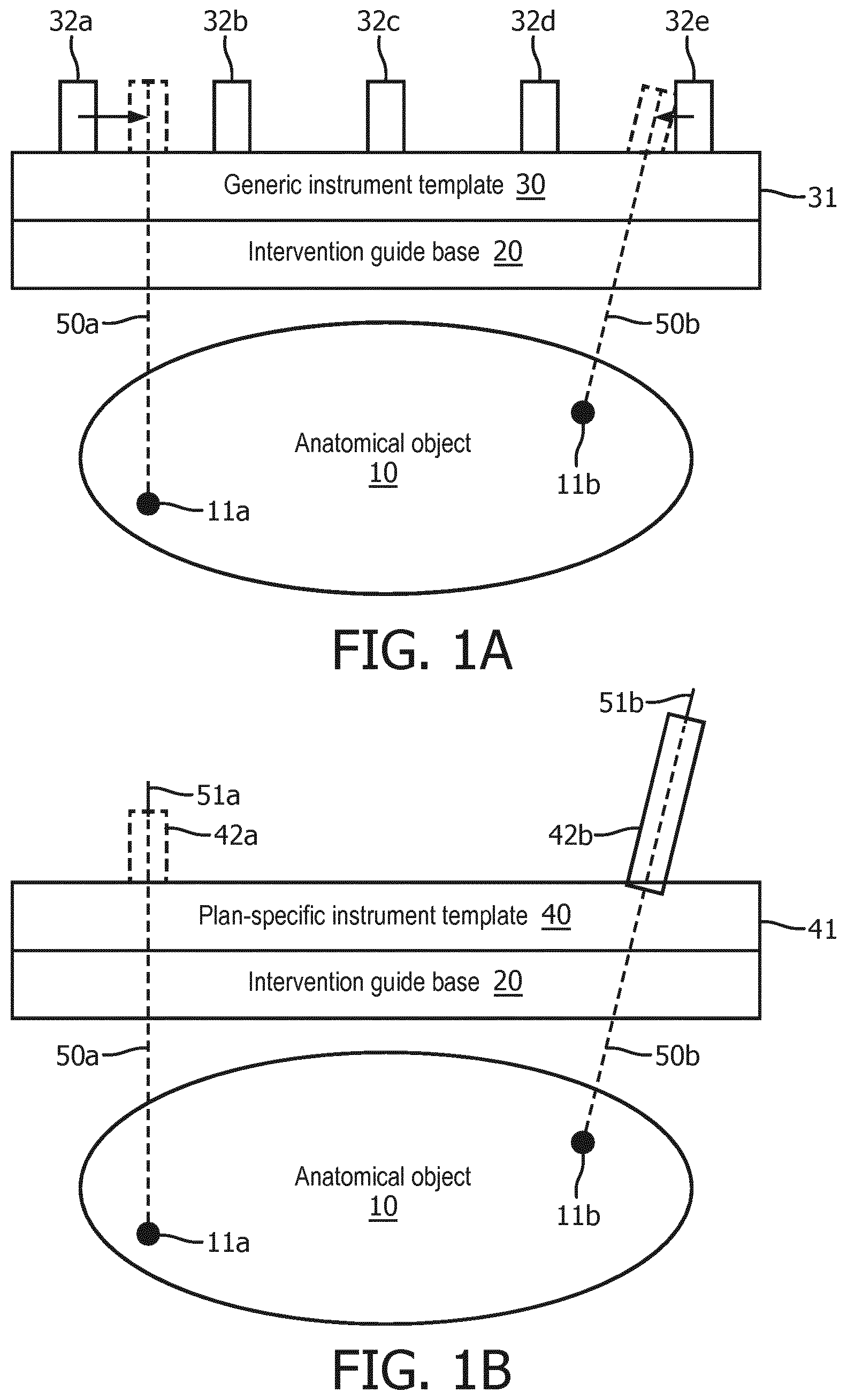Patent US12303338 Figure 1 – Plan-specific instrument template for percutaneous interventional procedures