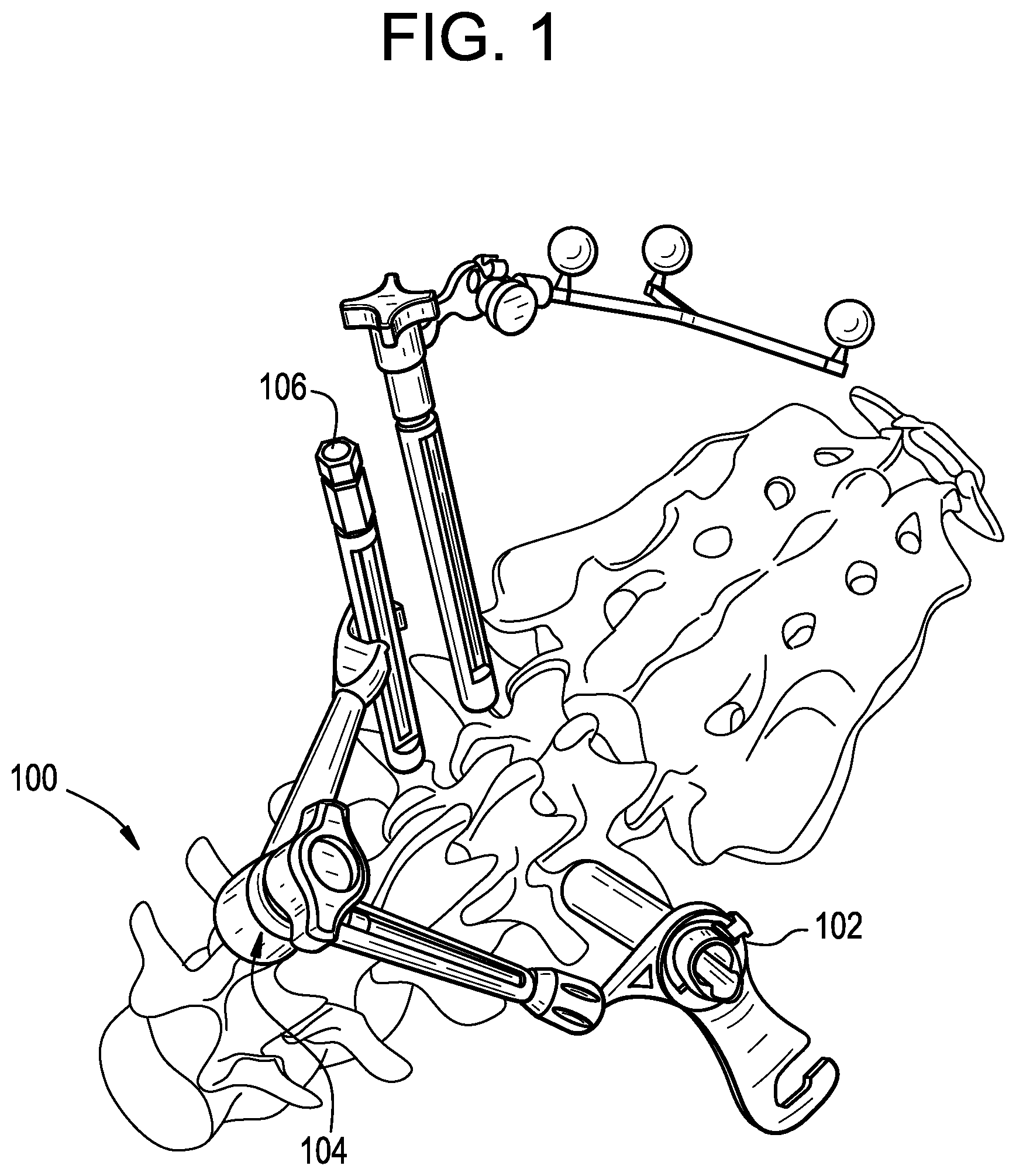 Patent US12303341 — Camera position indication systems and methods — Figure 1