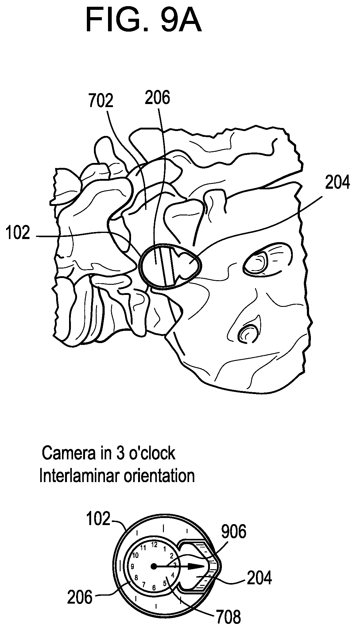 Patent US12303341 Figure 7 – Camera position indication systems and methods