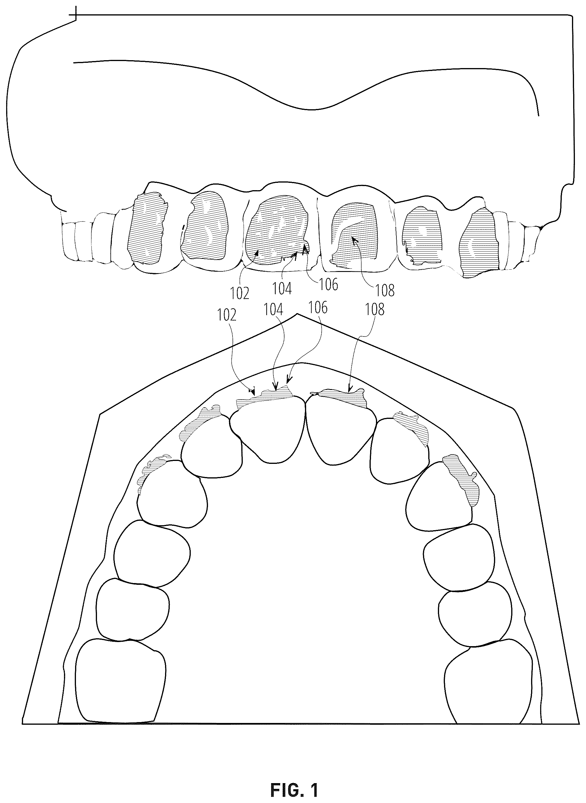 Patent US12303345 — Dental treatment tray — Figure 1