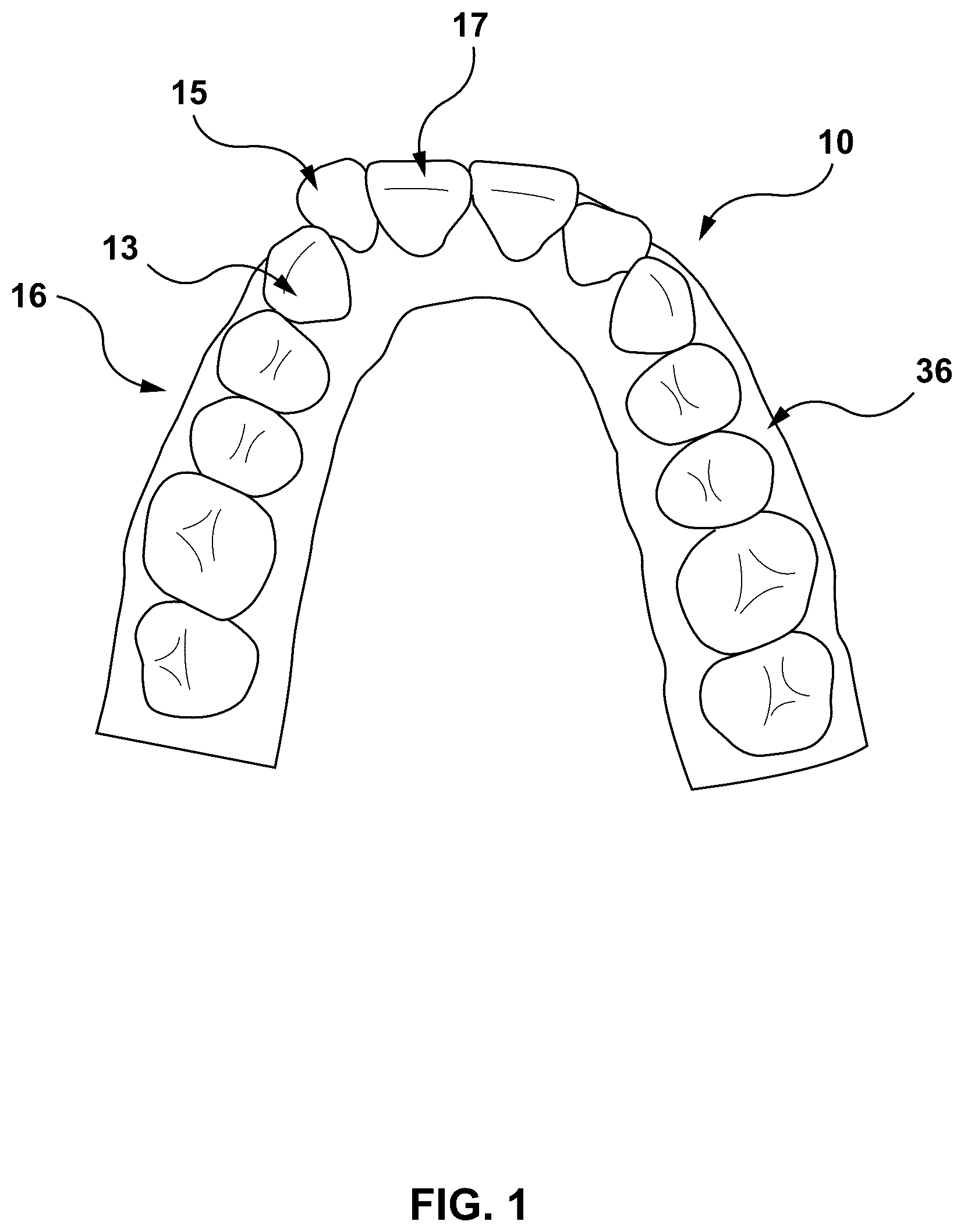 Patent US12303347 — Methods and systems for determining an orthodontic treatment — Figure 1