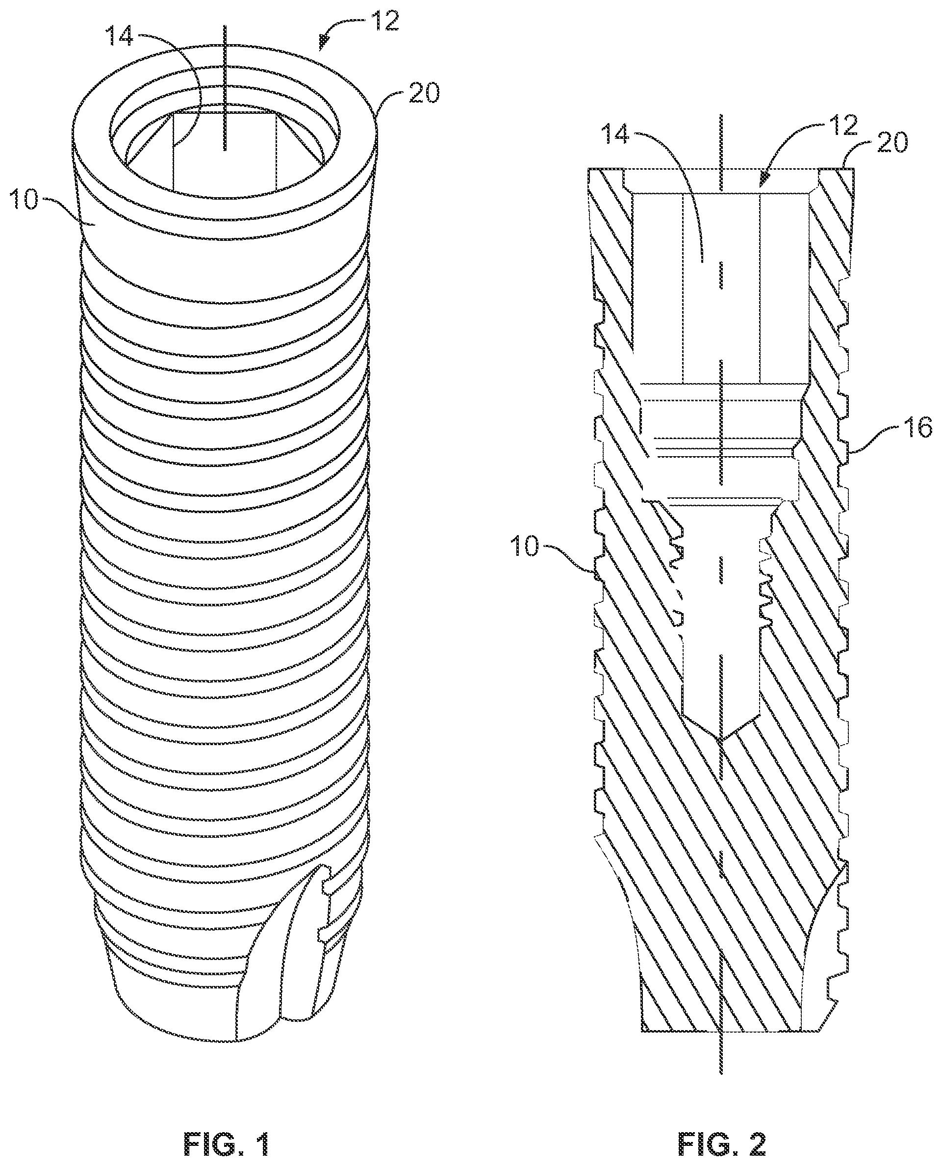 Patent US12303353 Figure 1 – Dental implant with coded upper surface
