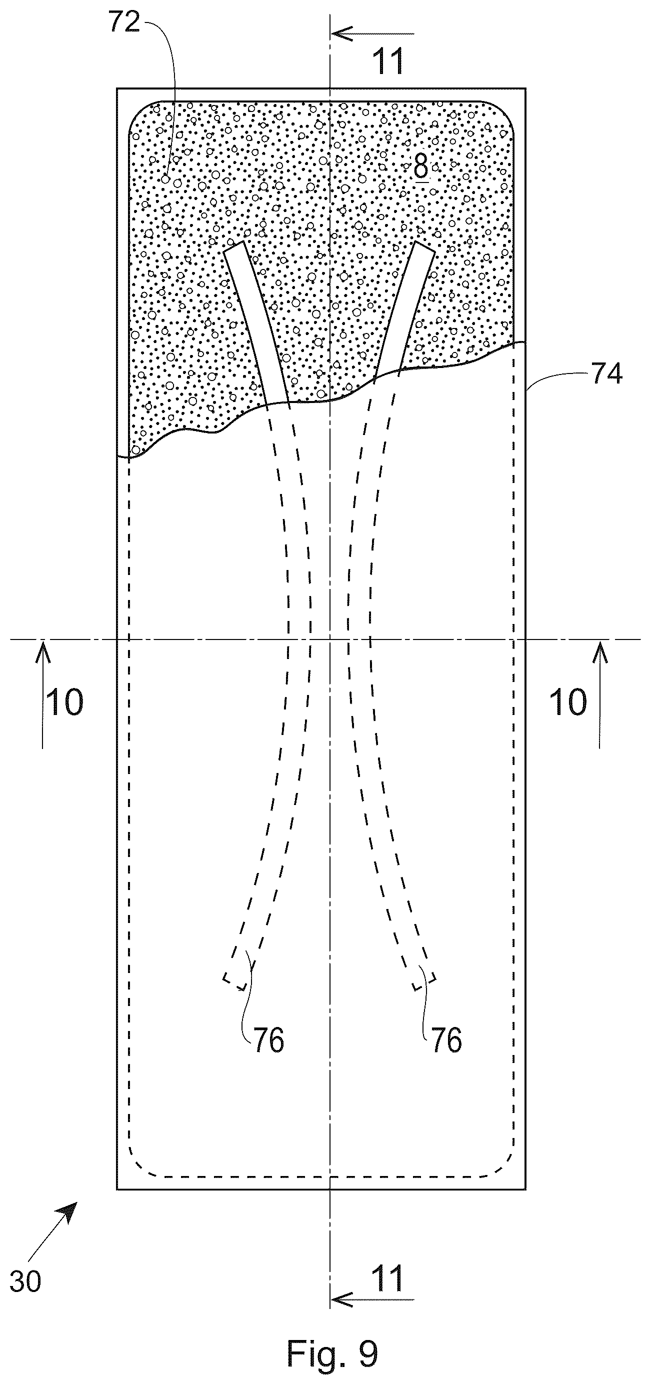 Patent US12303360 Figure 9 – Nonwoven webs with visually discernible patterns and improved texture perception