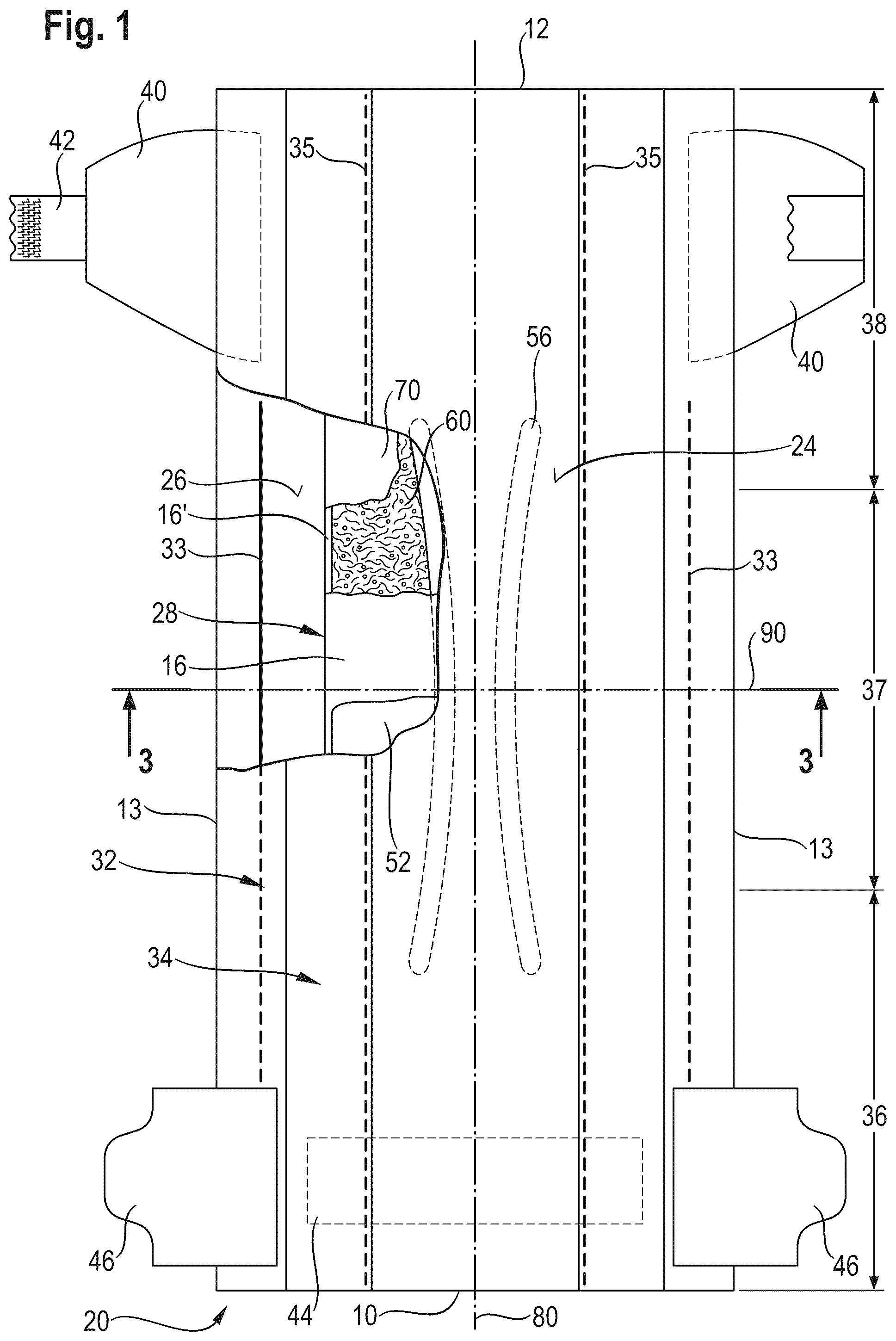 Patent US12303370 — Absorbent article with a channel-forming area and a masking layer — Figure 1