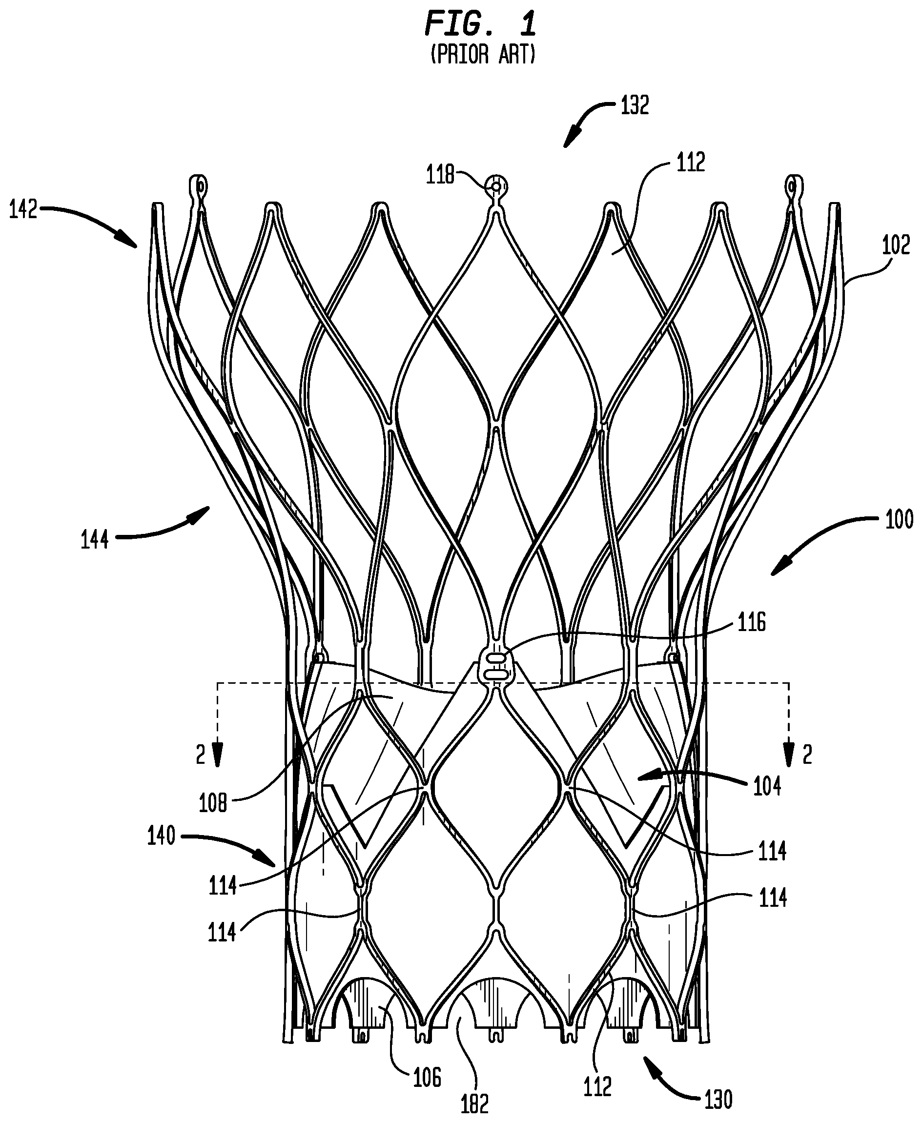 Patent US12303386 — Stent assembly for use in prosthetic heart valves — Figure 1
