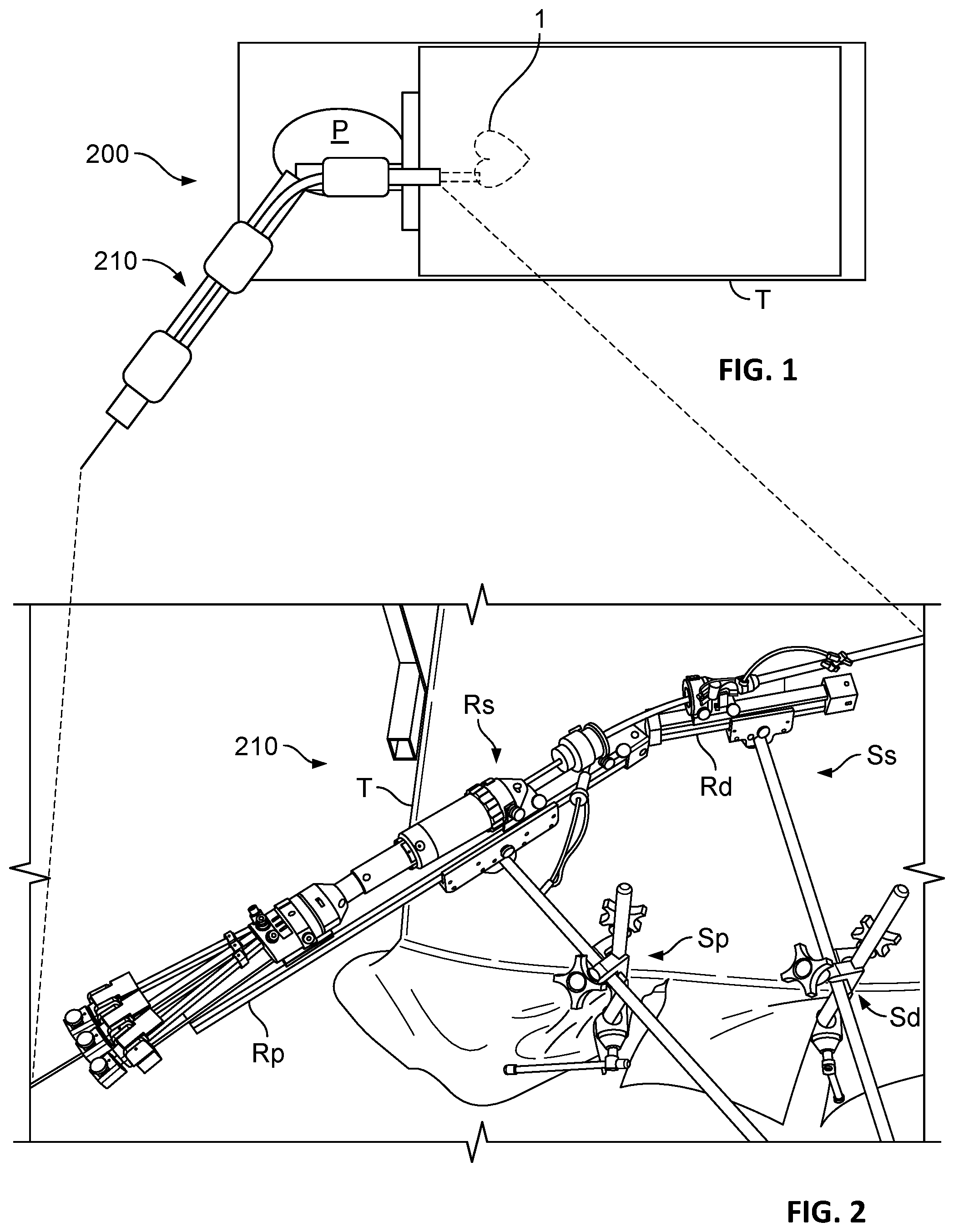 Patent US12303389 — Prosthetic heart valves — Figure 1