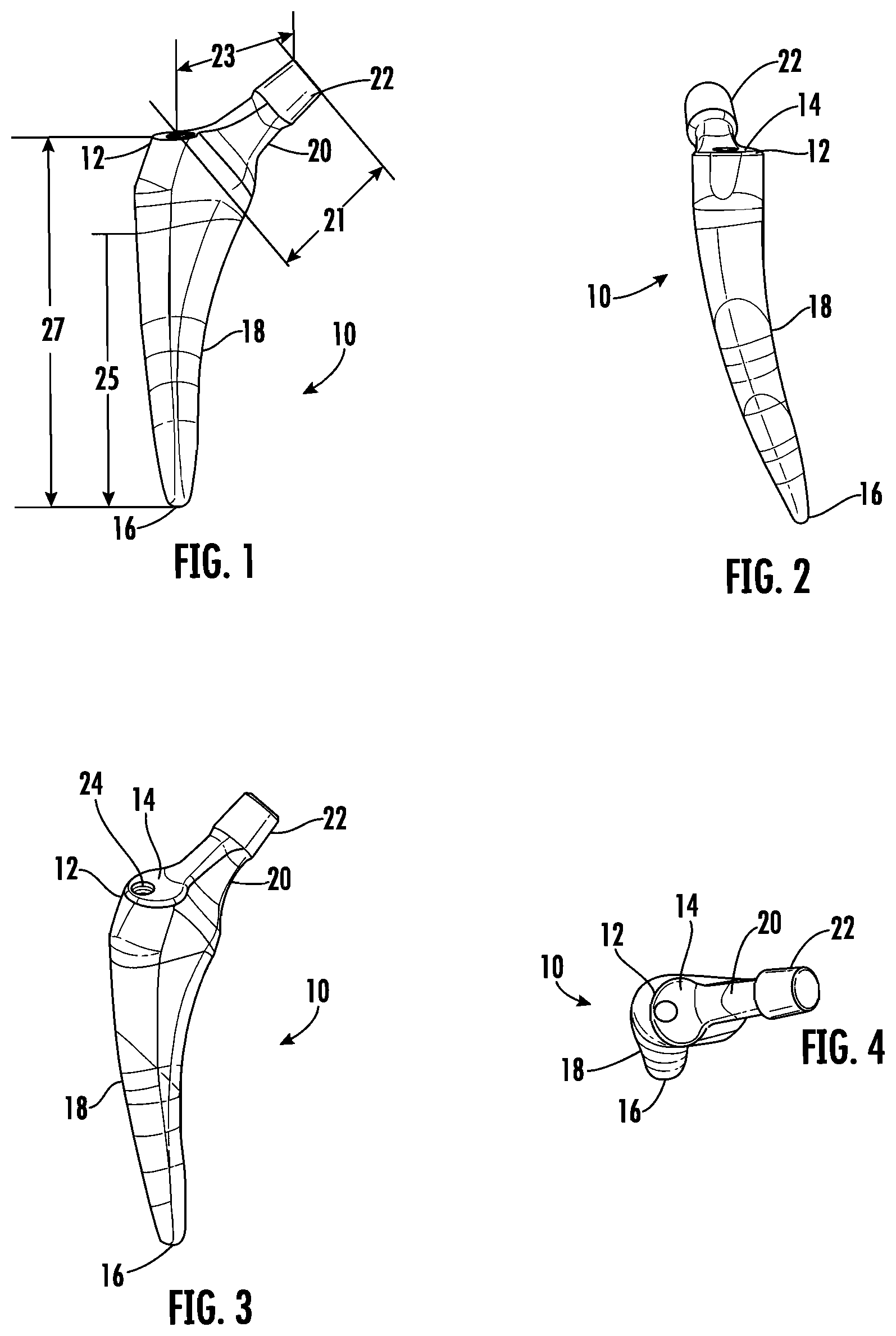 Patent US12303395 — Hip implant — Figure 1